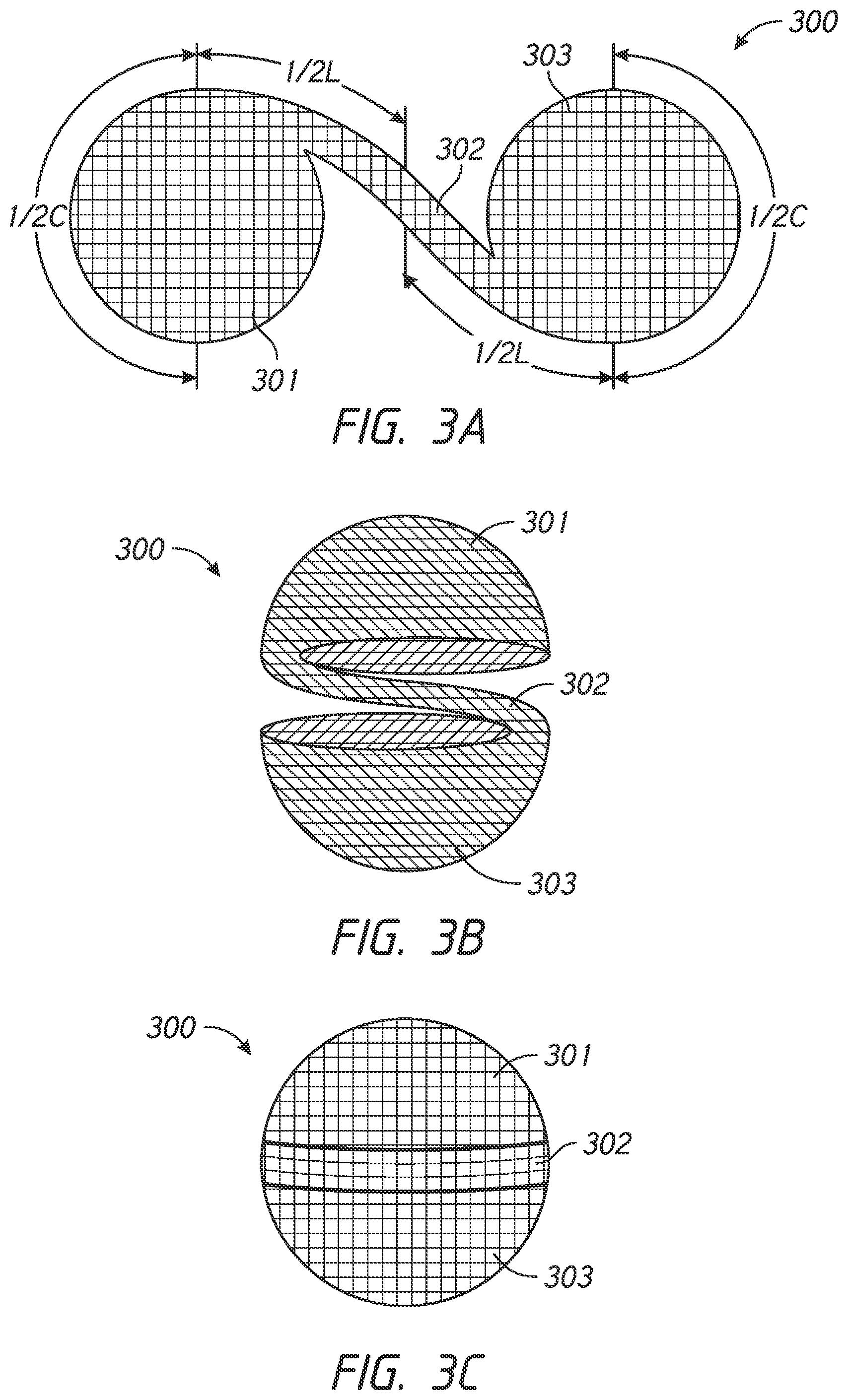 Patent US12303136 Figure 4 – System and methods for embolized occlusion of neurovascular aneurysms