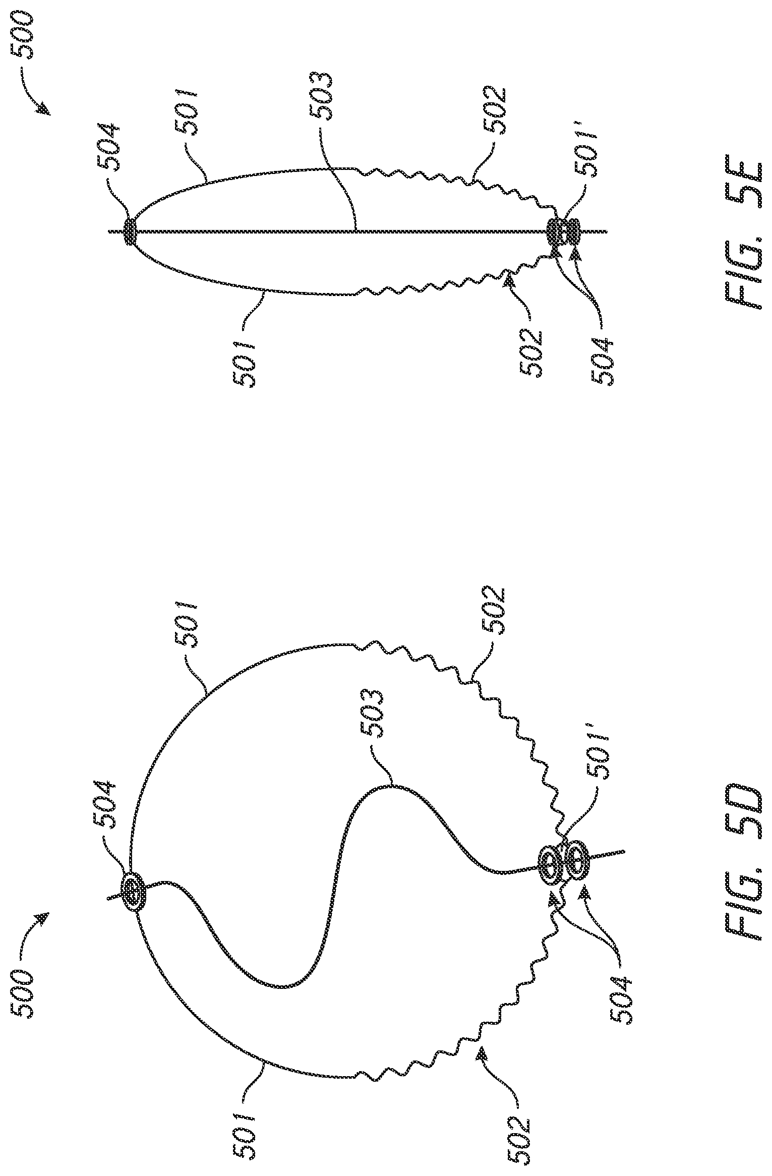 Patent US12303136 Figure 9 – System and methods for embolized occlusion of neurovascular aneurysms
