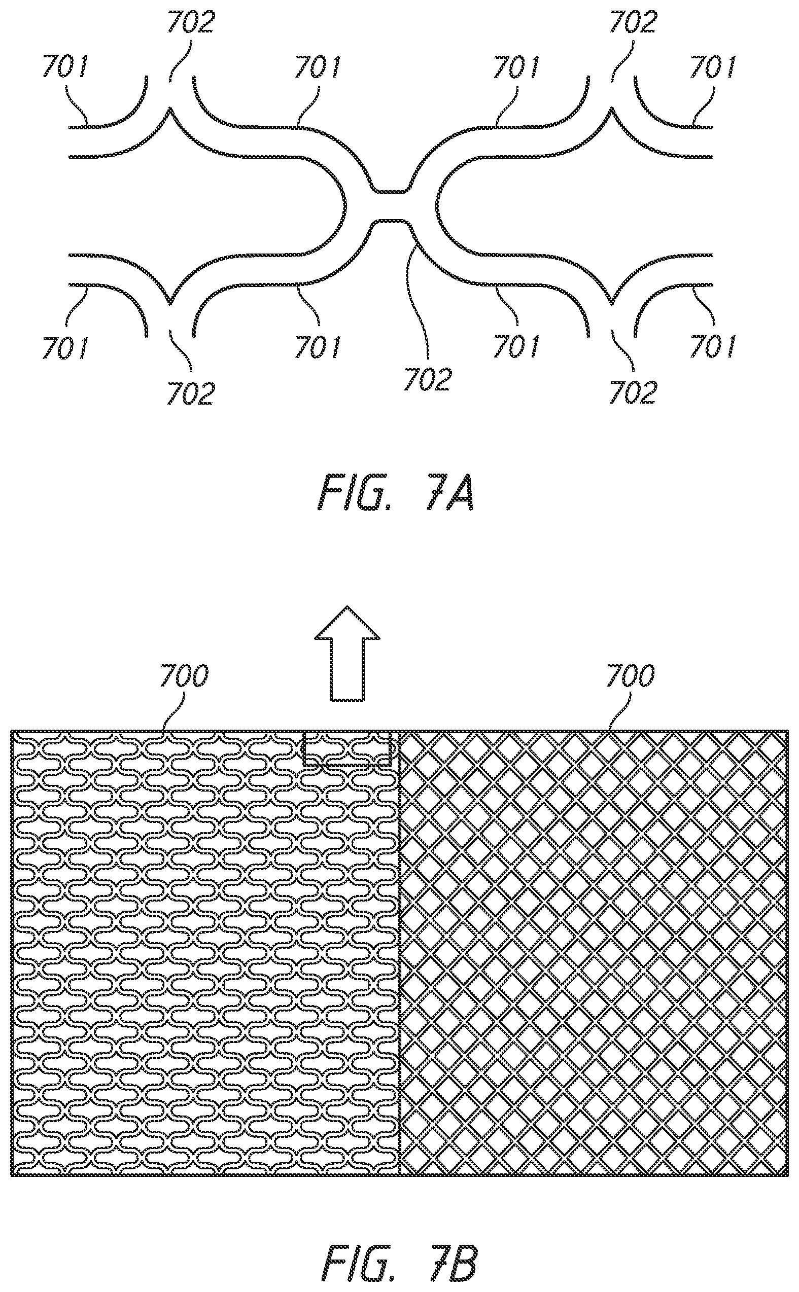 Patent US12303136 Figure 11 – System and methods for embolized occlusion of neurovascular aneurysms