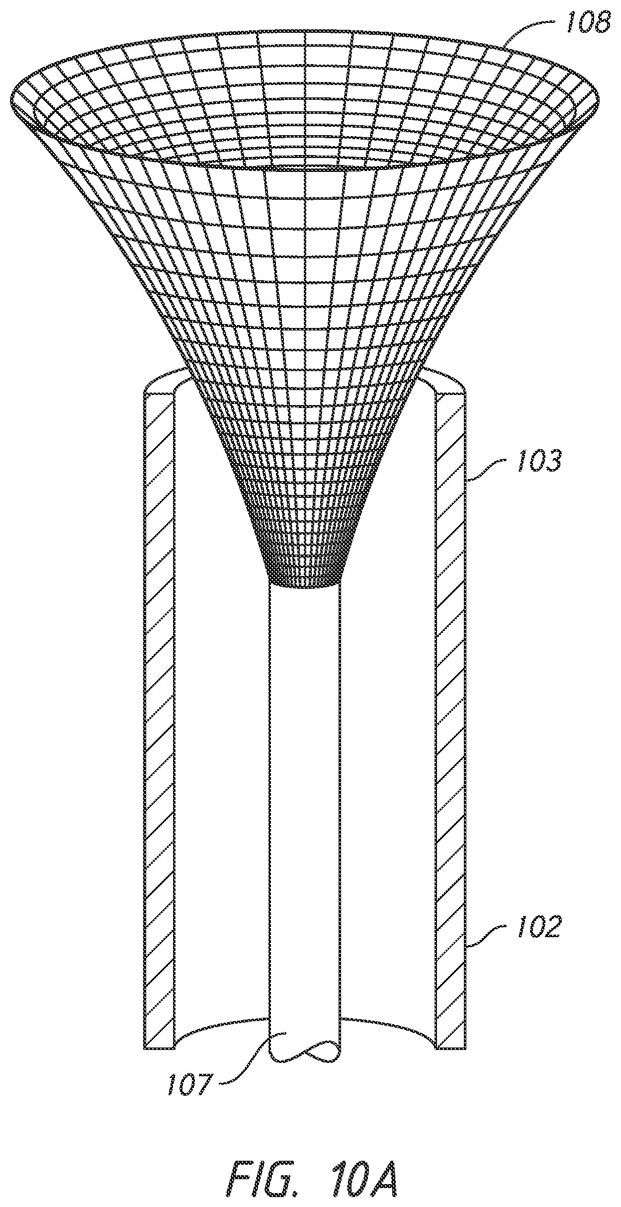 Patent US12303136 Figure 14 – System and methods for embolized occlusion of neurovascular aneurysms
