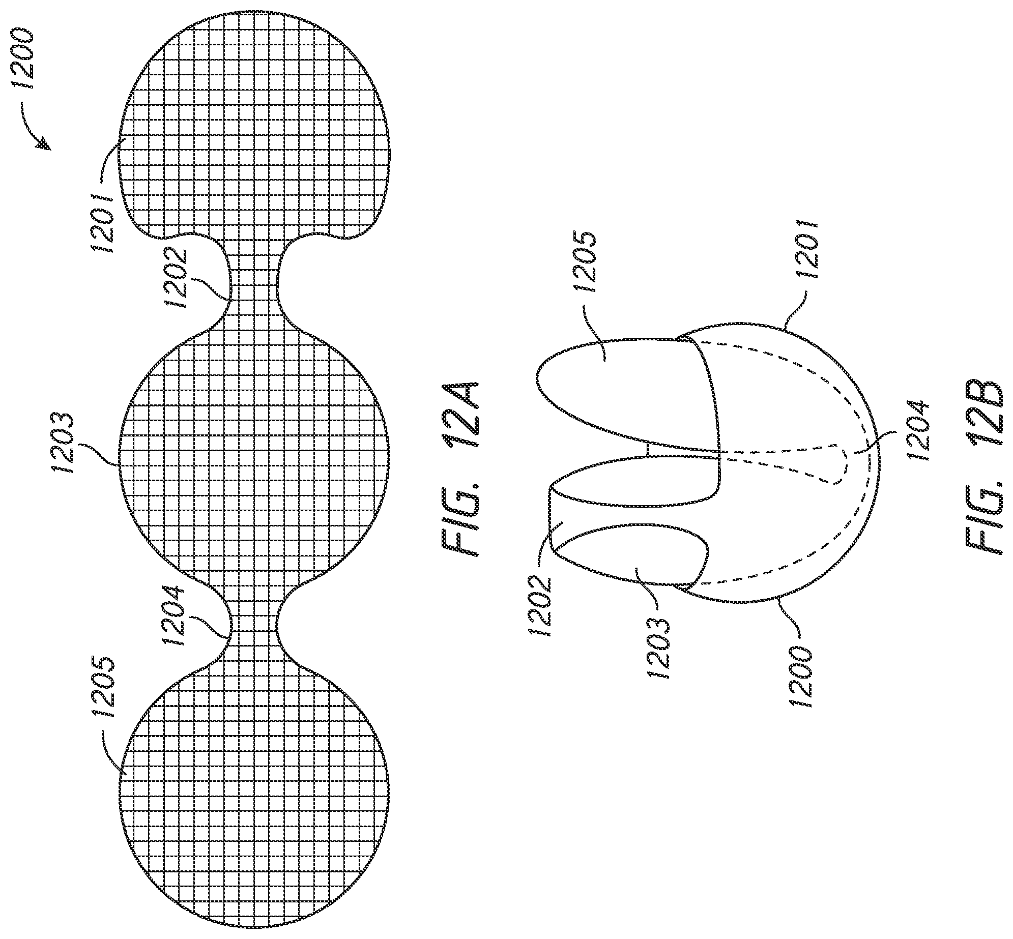 Patent US12303136 Figure 17 – System and methods for embolized occlusion of neurovascular aneurysms