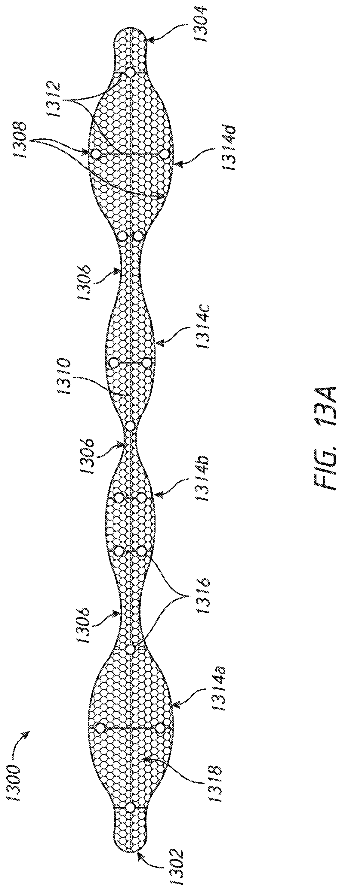 Patent US12303136 Figure 18 – System and methods for embolized occlusion of neurovascular aneurysms