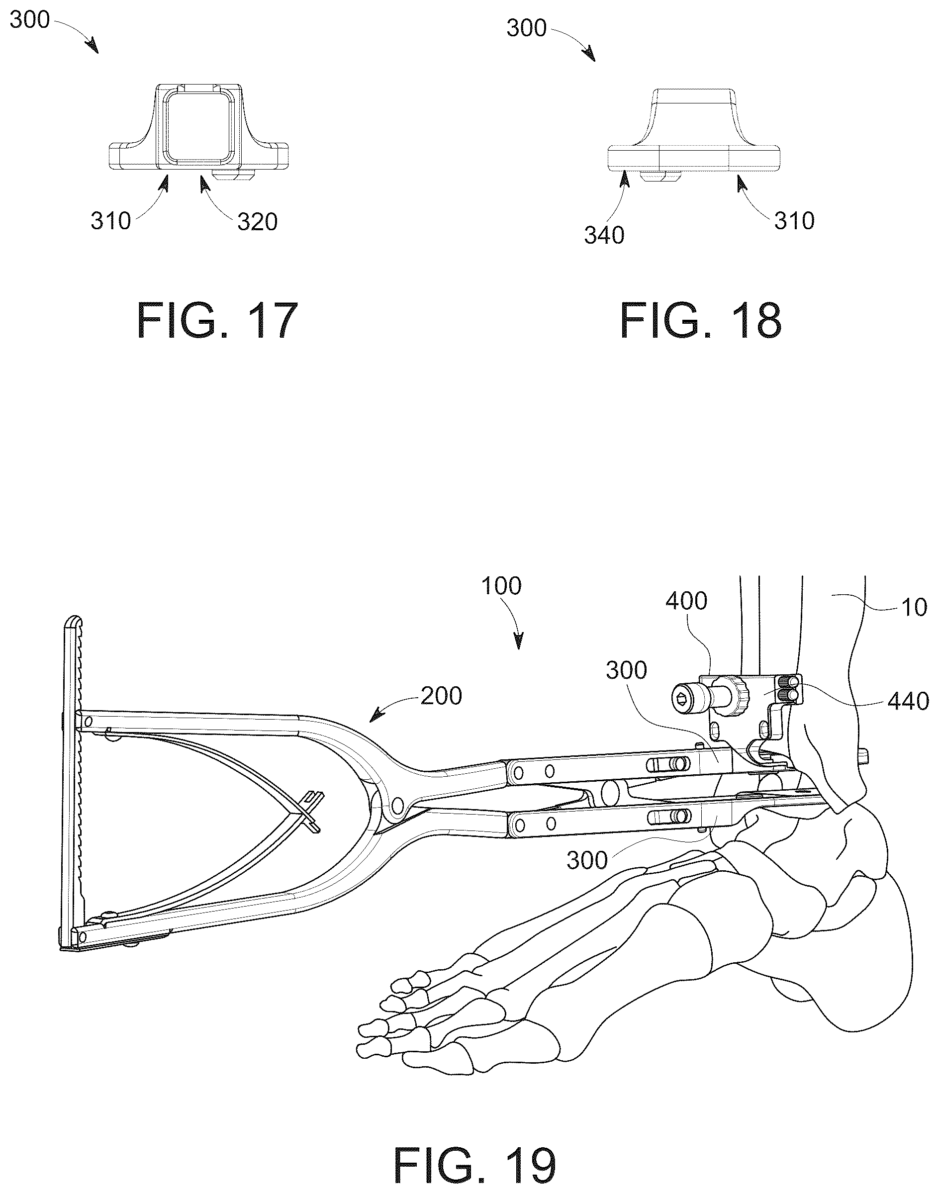 Patent US12303138 Figure 7 – Distractors having attachable paddles, impaction devices, and methods for use in total ankle replacement