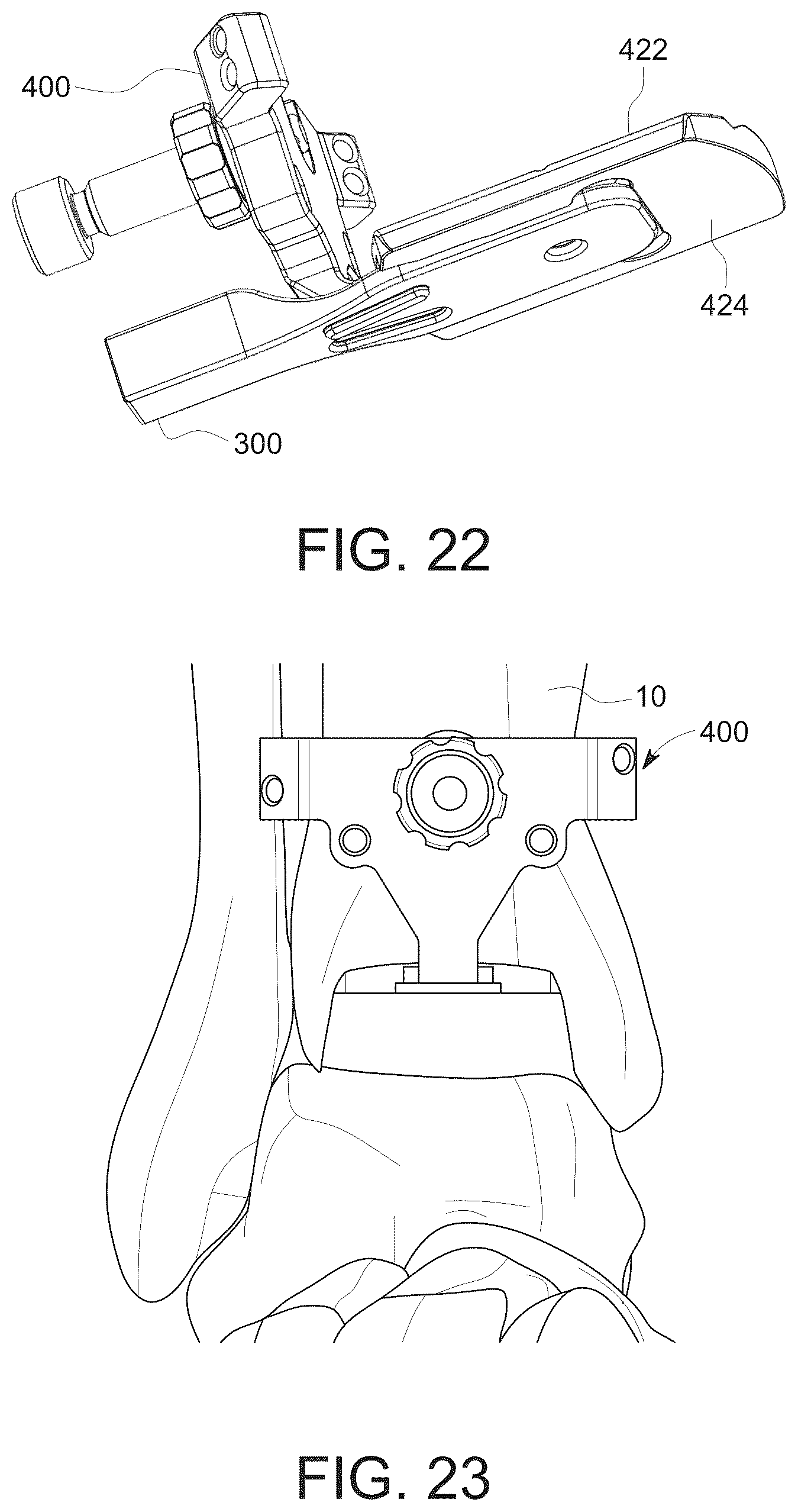 Patent US12303138 Figure 9 – Distractors having attachable paddles, impaction devices, and methods for use in total ankle replacement