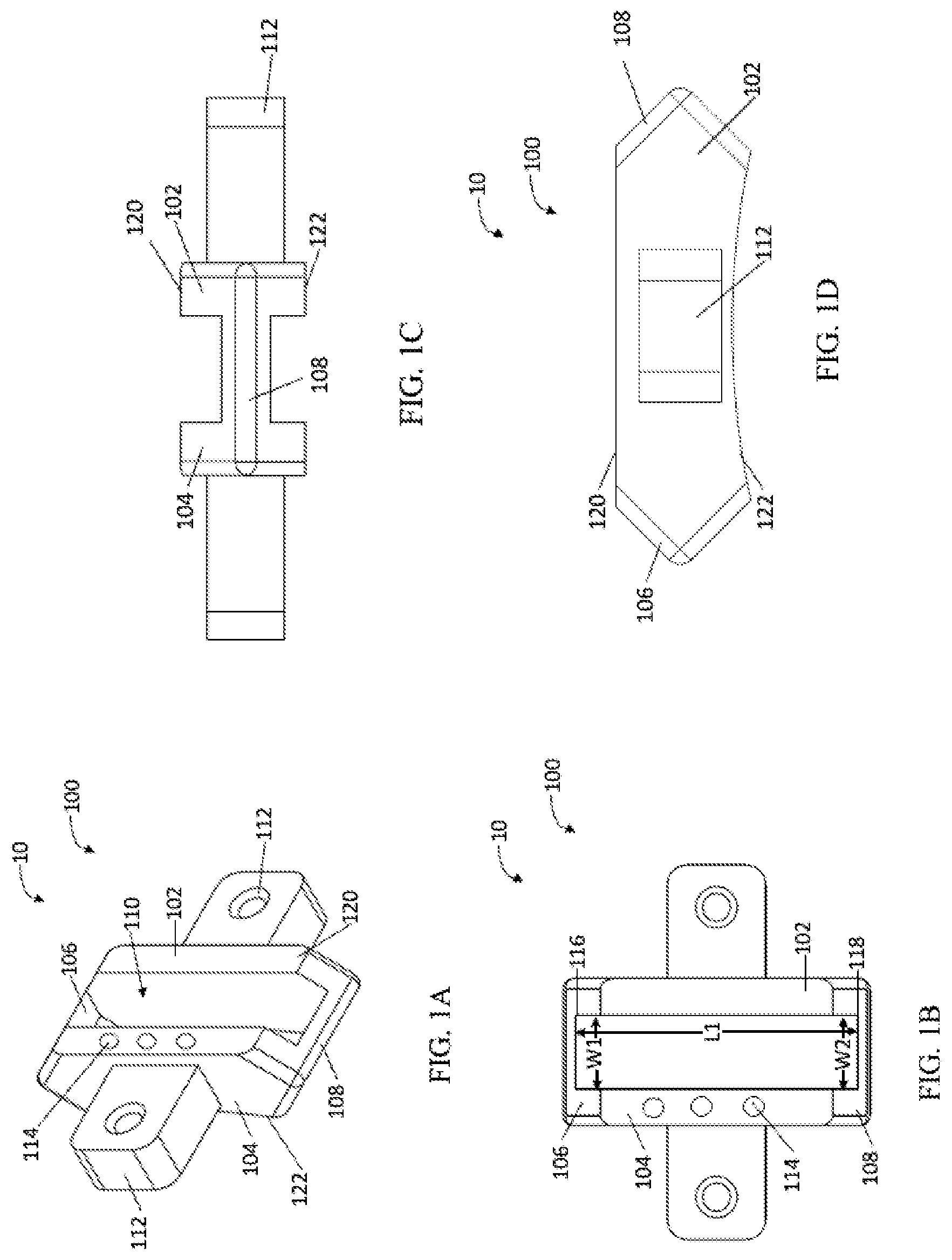 Patent US12303140 Figure 1 – Surgical systems and methods including cutting and aligning guides for performing an osteotomy