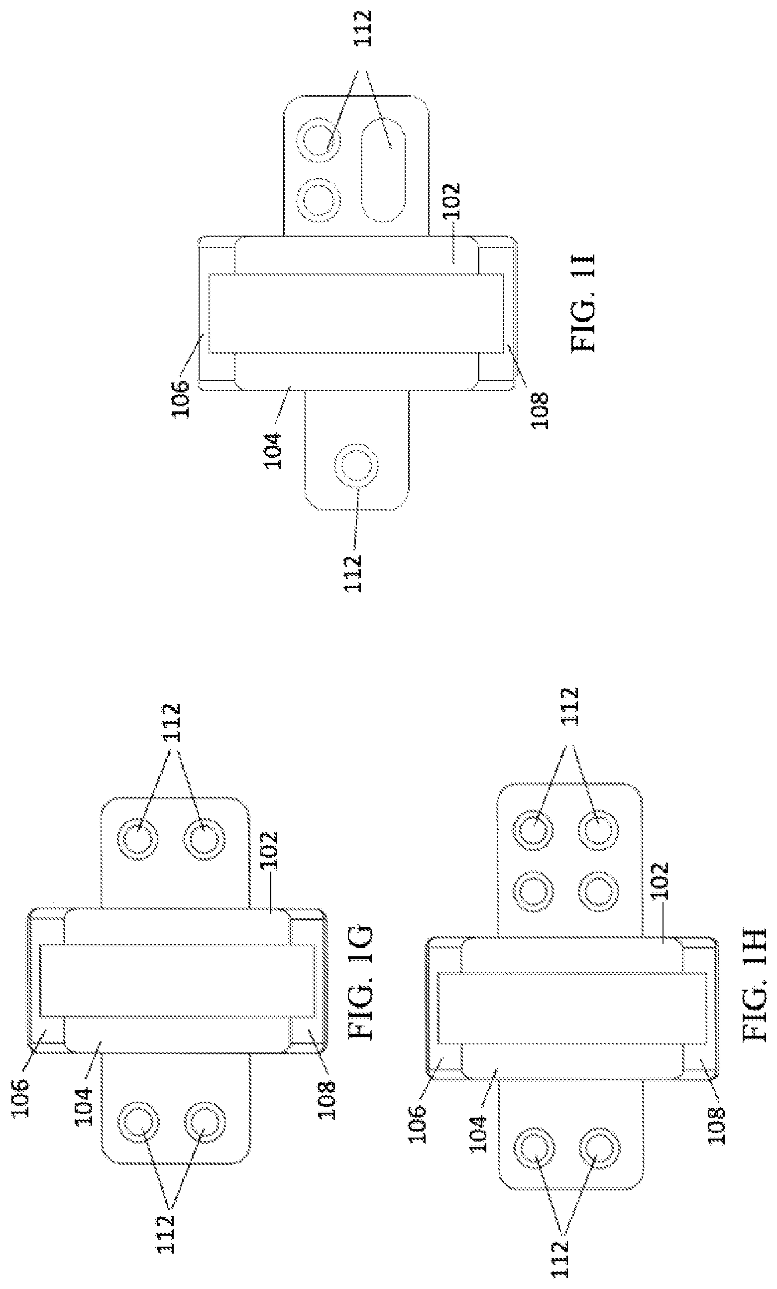 Patent US12303140 Figure 3 – Surgical systems and methods including cutting and aligning guides for performing an osteotomy
