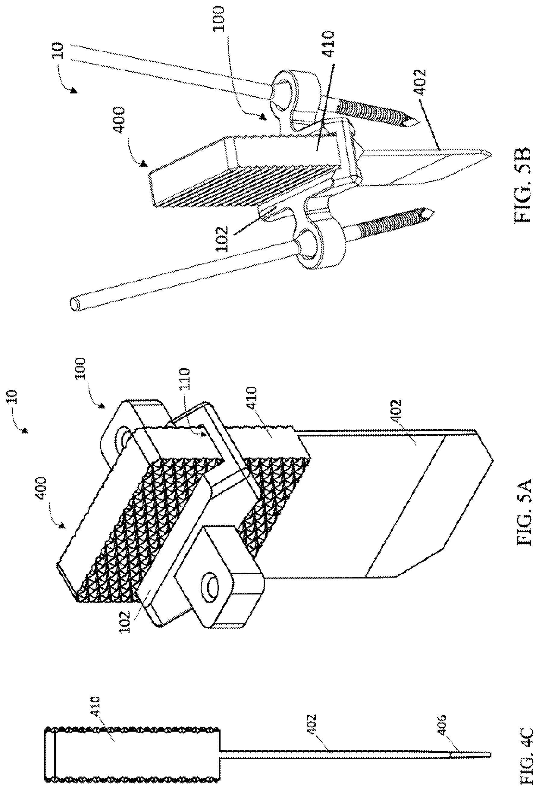 Patent US12303140 Figure 10 – Surgical systems and methods including cutting and aligning guides for performing an osteotomy