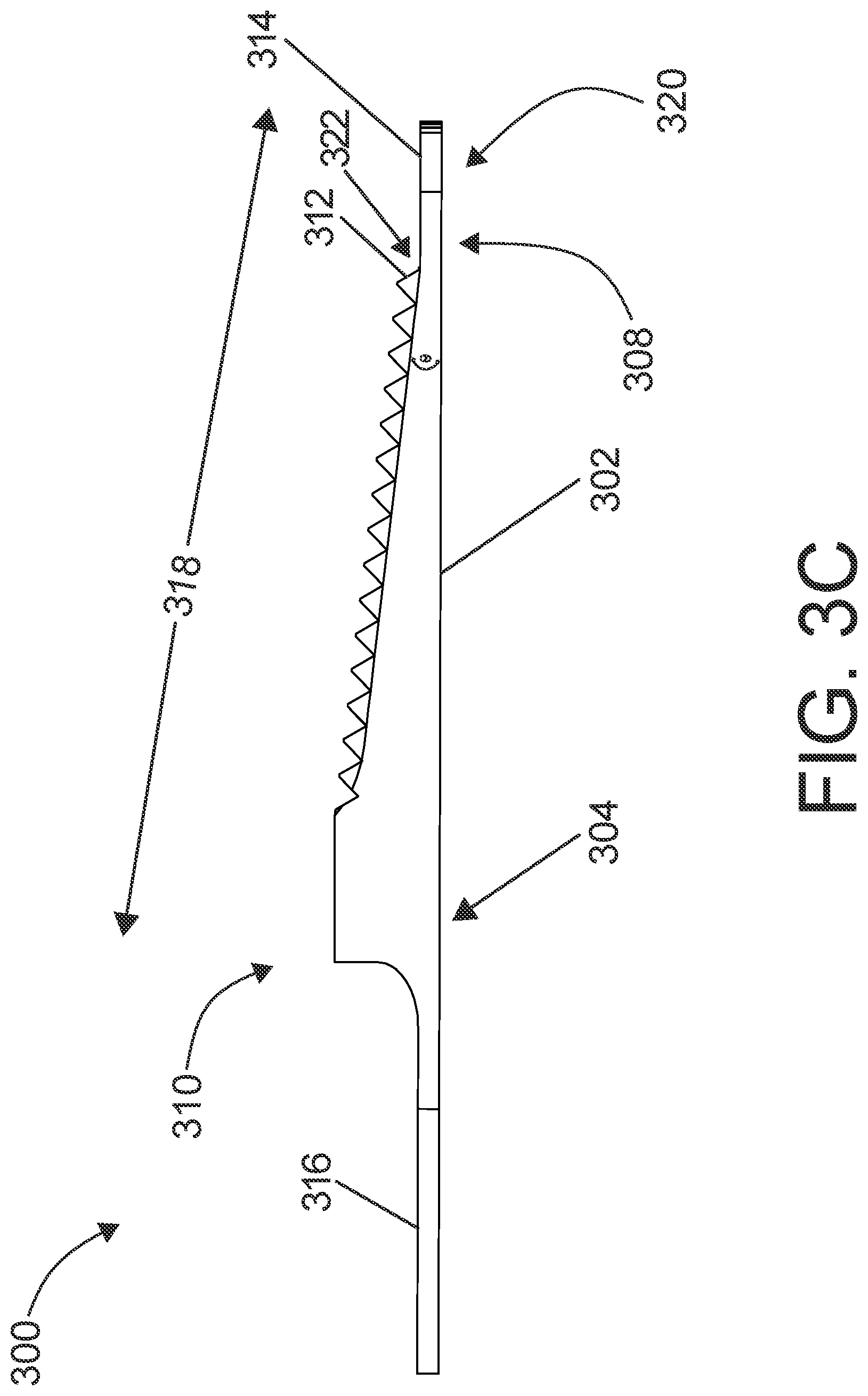 Patent US12303144 Figure 13 – Surgical instruments including a set of cutting burrs for performing an osteotomy