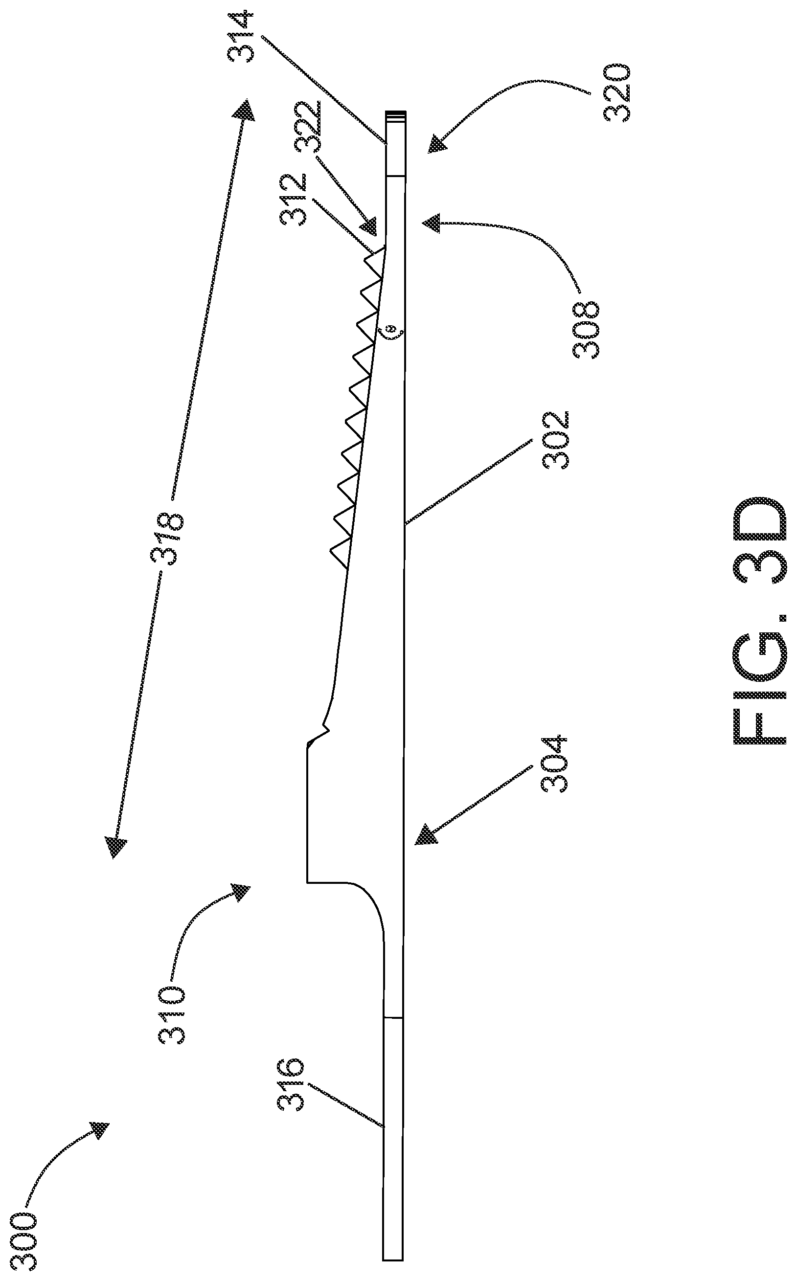 Patent US12303144 Figure 14 – Surgical instruments including a set of cutting burrs for performing an osteotomy