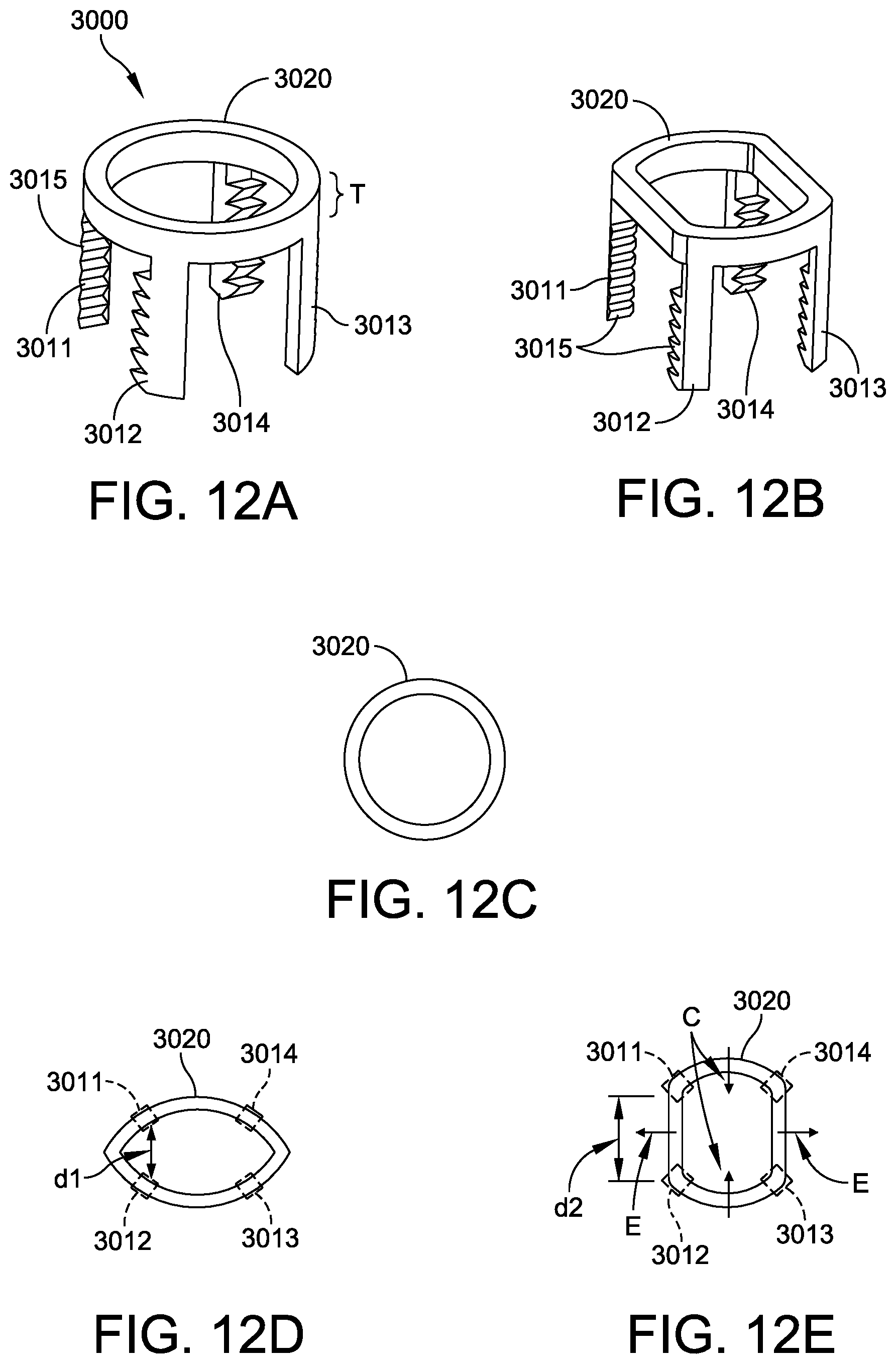Patent US12303147 Figure 18 – Orthopedic staple and related instruments