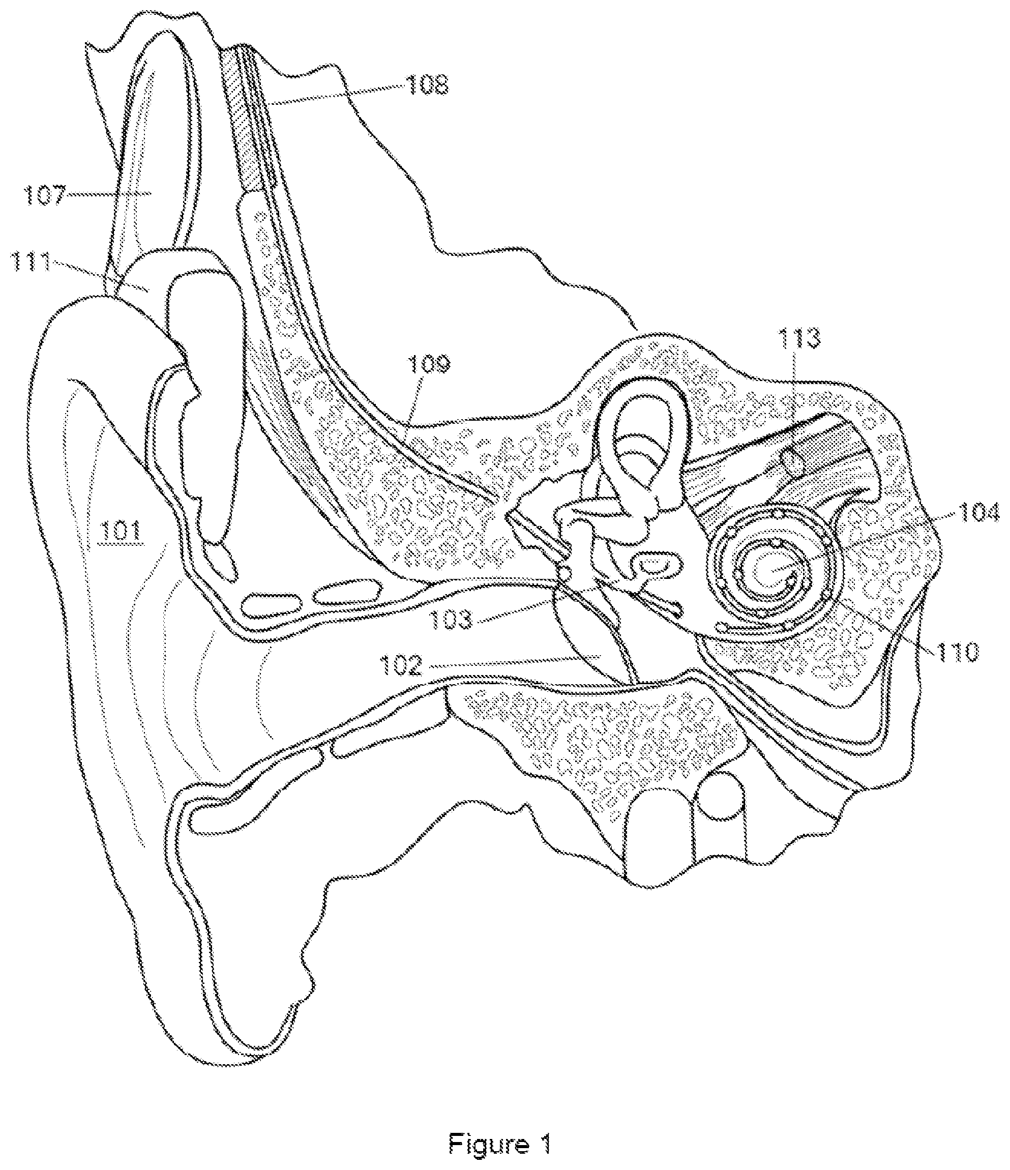 Patent US12303148 — Drilling platform tool for surgeries — Figure 1