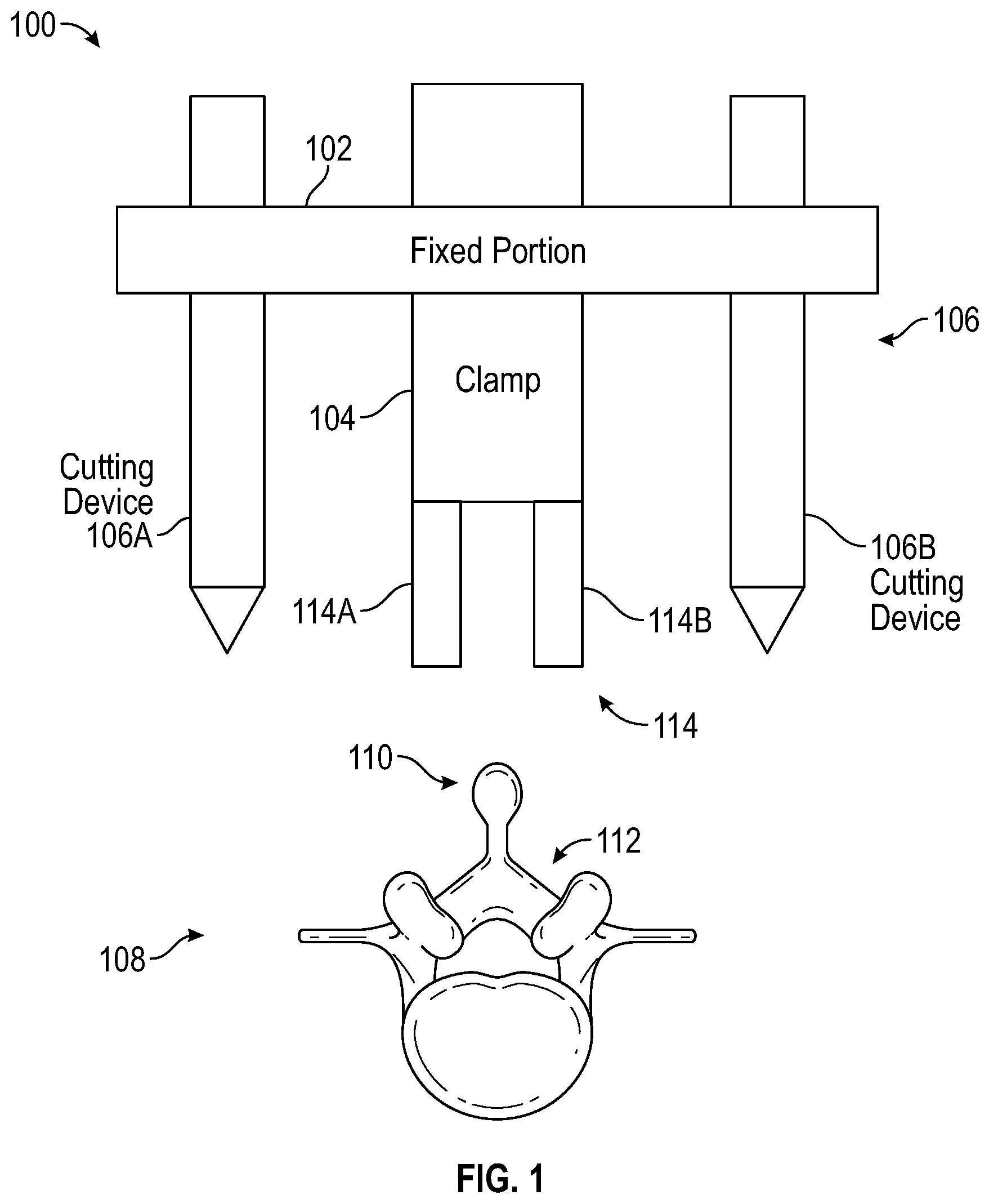 Patent US12303149 Figure 1 – Apparatus for incision and removal of osseous tissue and methods thereof