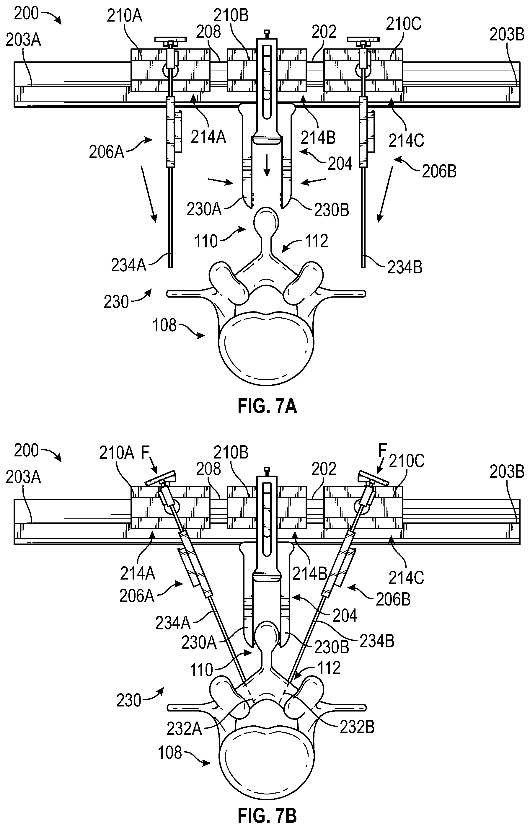Patent US12303149 Figure 6 – Apparatus for incision and removal of osseous tissue and methods thereof