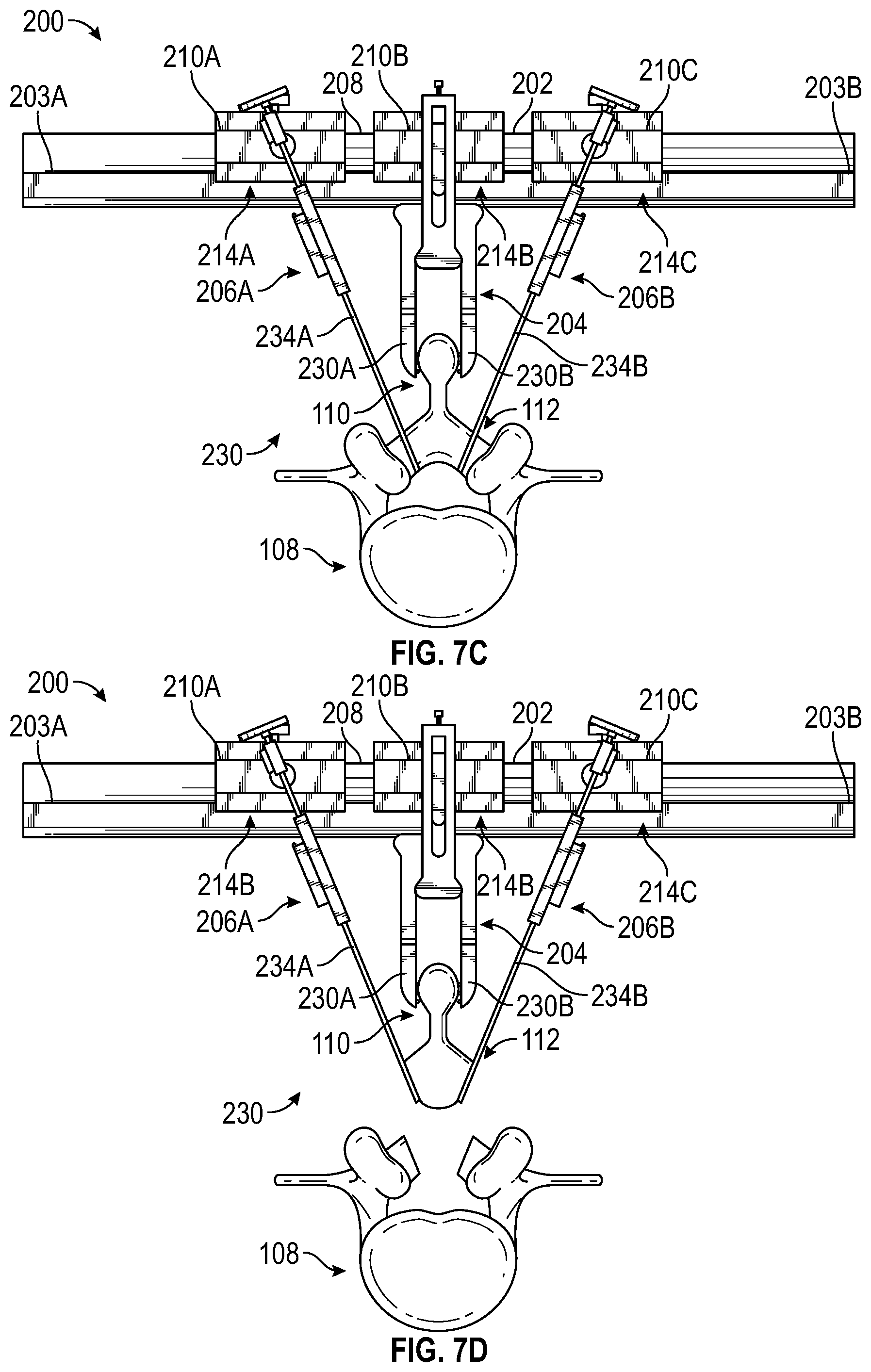 Patent US12303149 Figure 7 – Apparatus for incision and removal of osseous tissue and methods thereof
