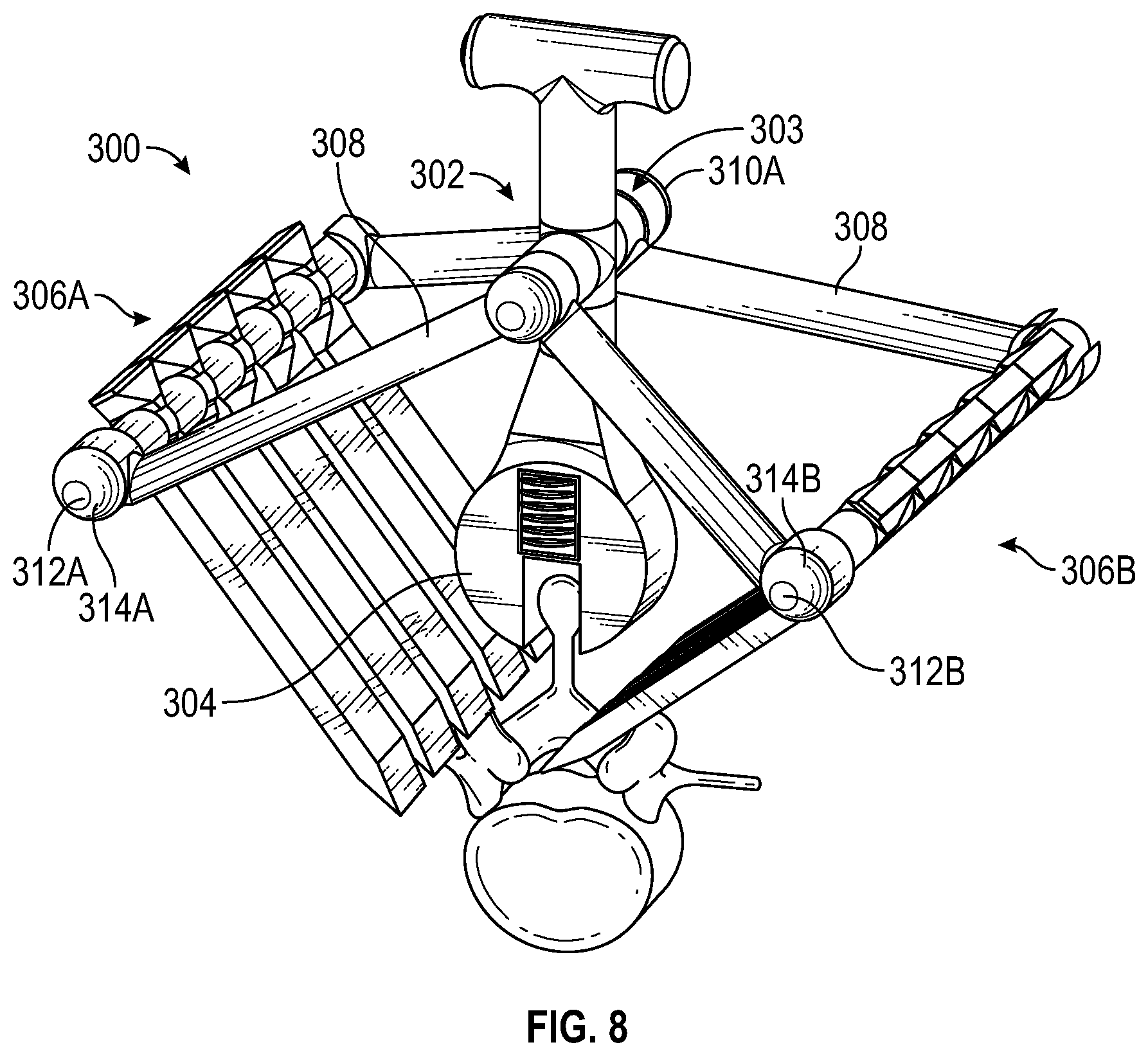 Patent US12303149 Figure 8 – Apparatus for incision and removal of osseous tissue and methods thereof