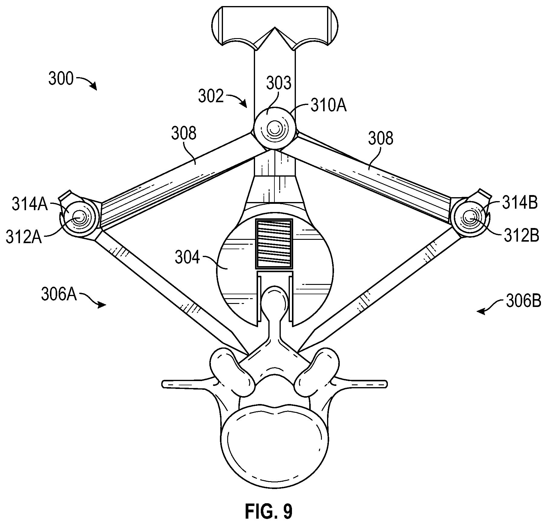 Patent US12303149 Figure 9 – Apparatus for incision and removal of osseous tissue and methods thereof