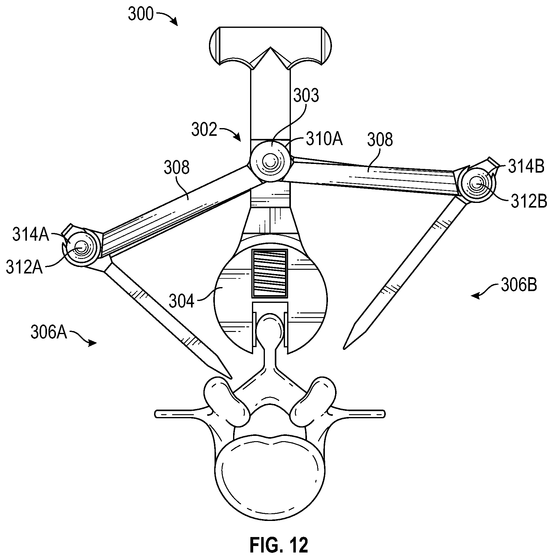 Patent US12303149 Figure 11 – Apparatus for incision and removal of osseous tissue and methods thereof