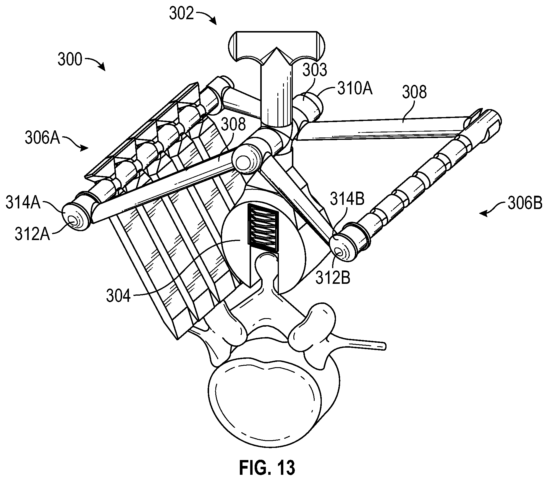 Patent US12303149 Figure 12 – Apparatus for incision and removal of osseous tissue and methods thereof