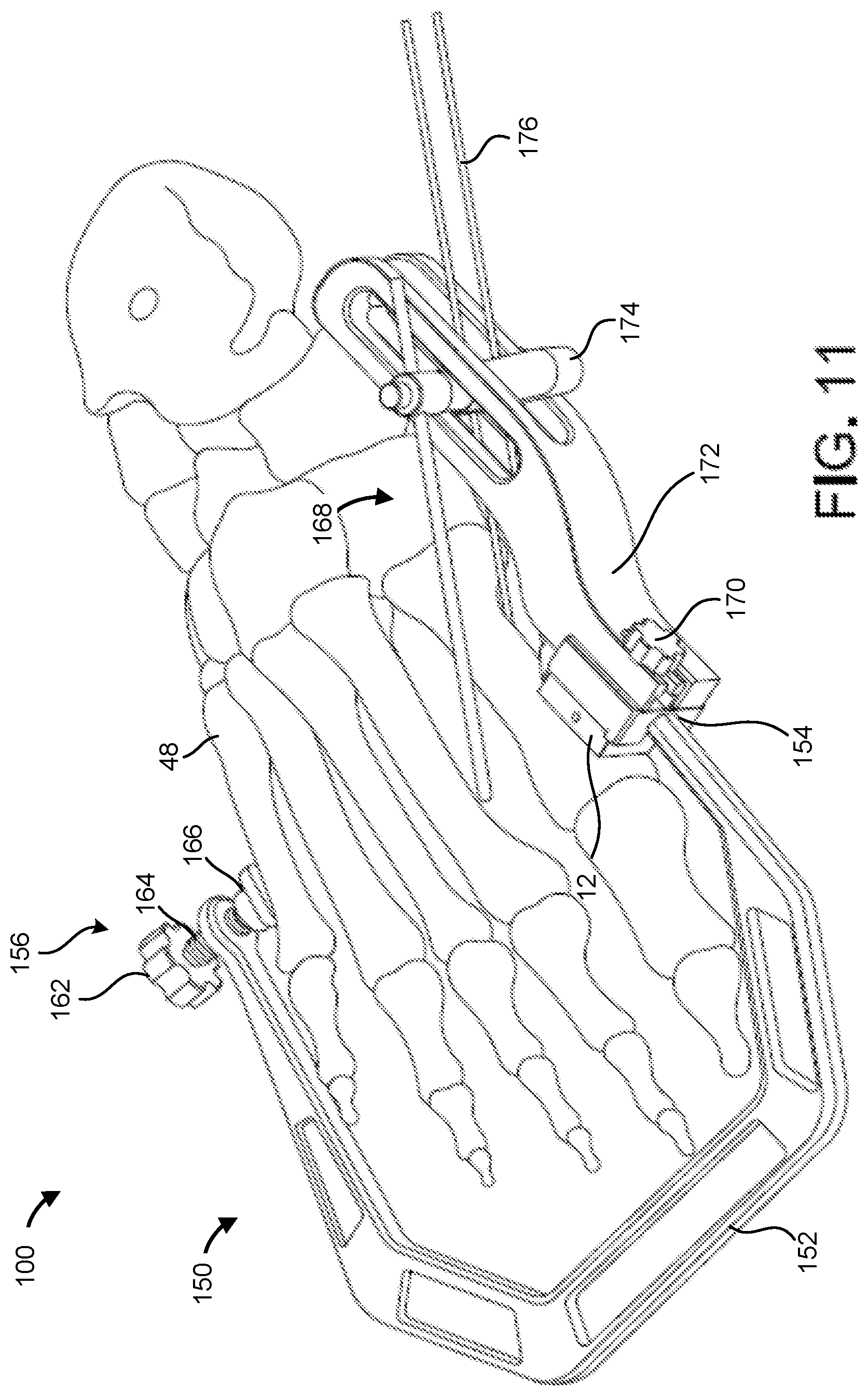 Patent US12303150 Figure 10 – Cut guide, systems, and methods