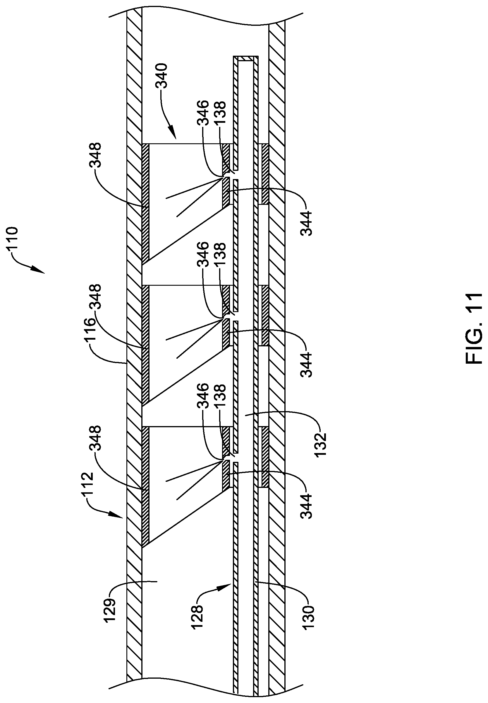 Patent US12303151 Figure 11 – Aspiration medical device