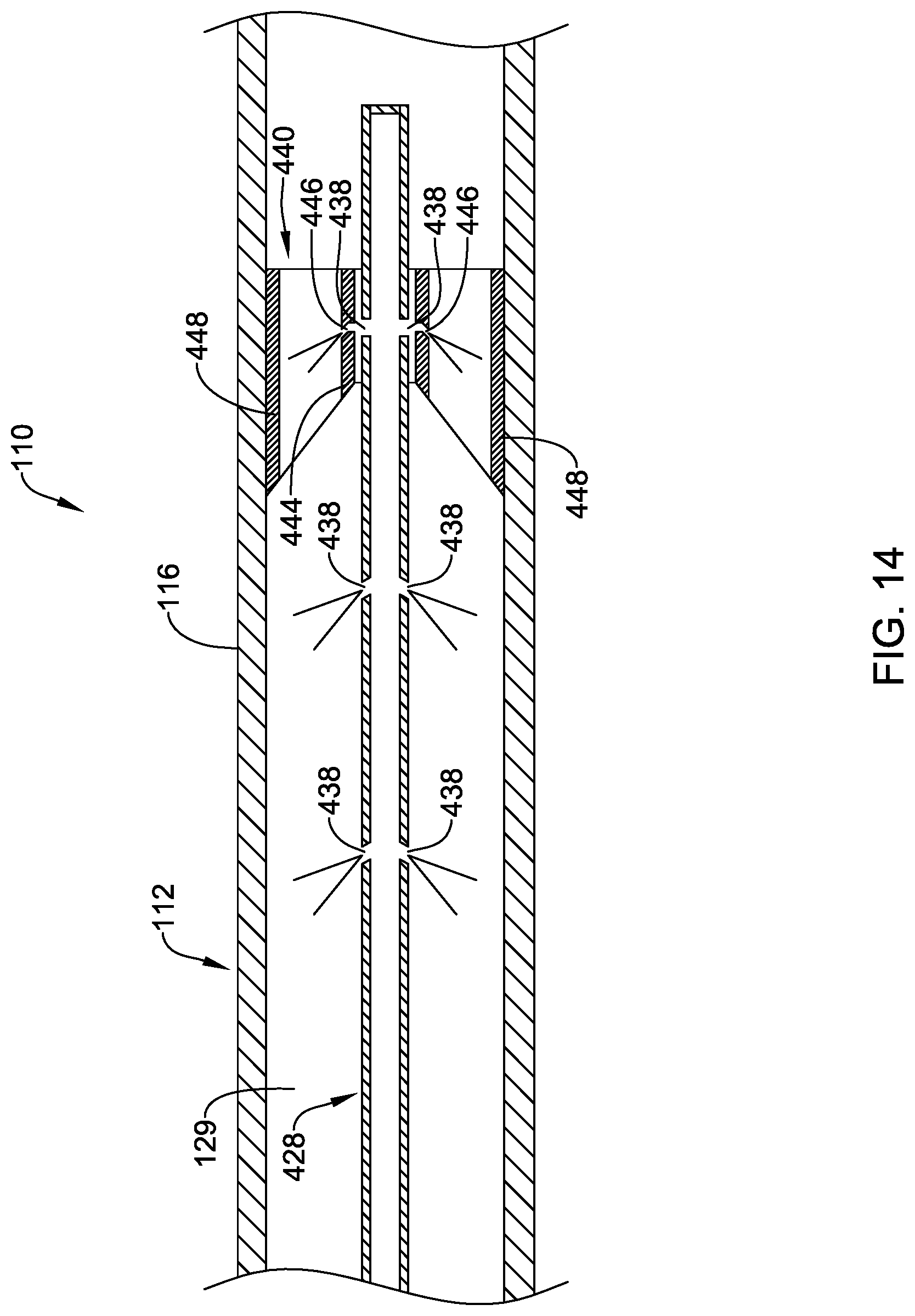 Patent US12303151 Figure 14 – Aspiration medical device