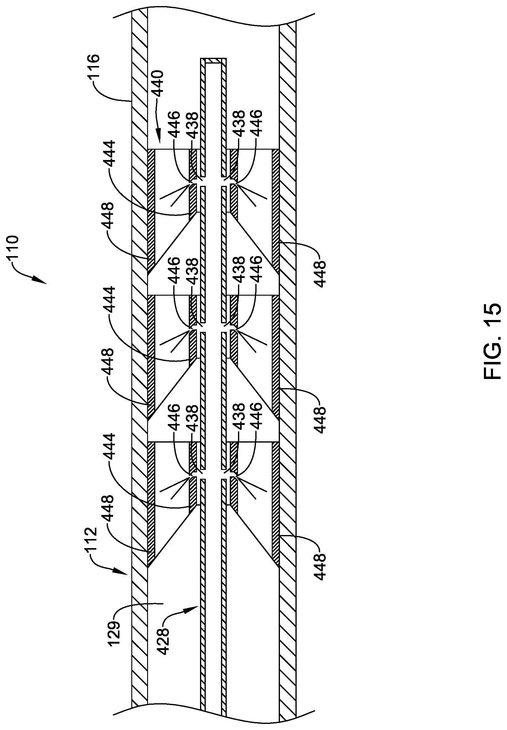Patent US12303151 Figure 15 – Aspiration medical device