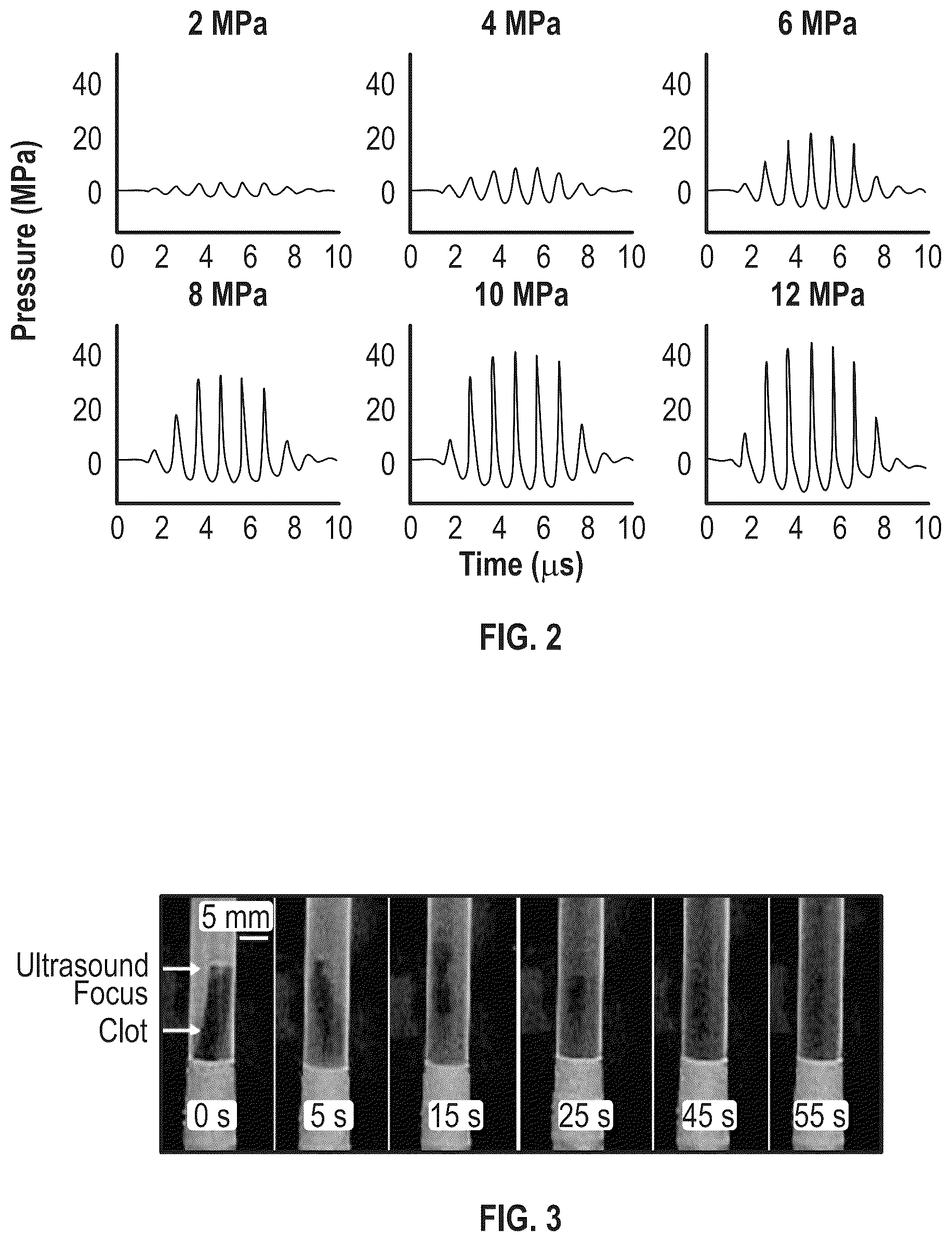 Patent US12303152 Figure 2 – Histotripsy for thrombolysis