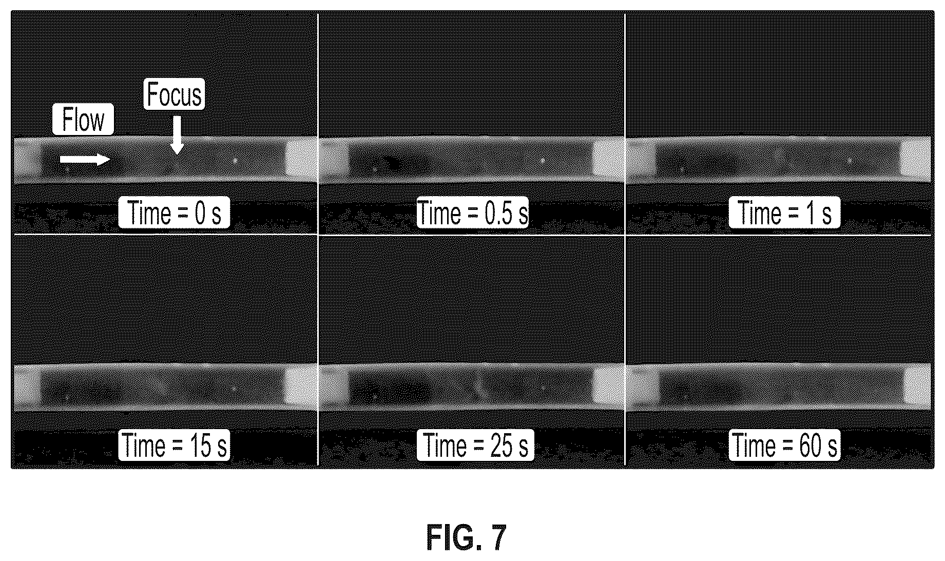 Patent US12303152 Figure 6 – Histotripsy for thrombolysis