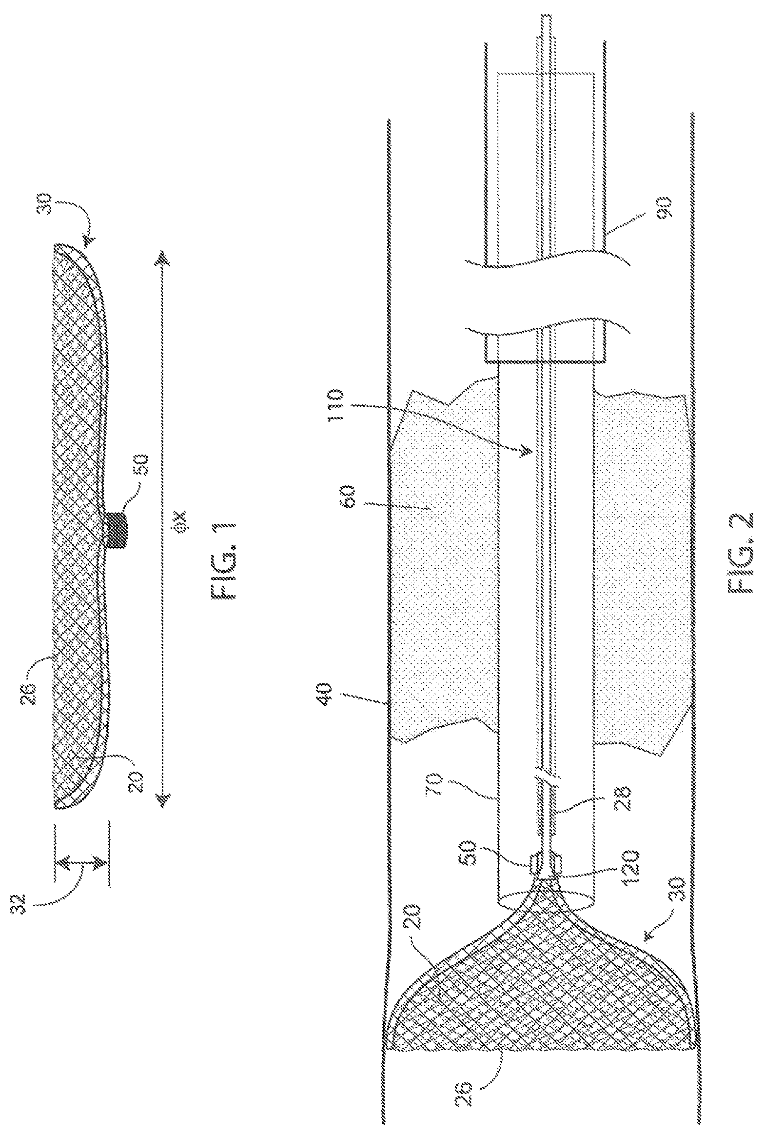 Patent US12303153 — Clot removal distal protection methods — Figure 1