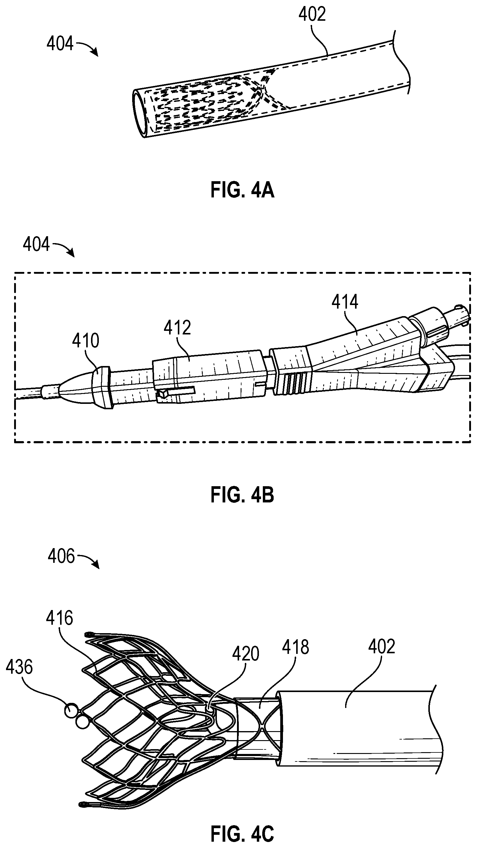 Patent US12303160 Figure 4 – Deployable dynamic stent and adjustable cutting jet device