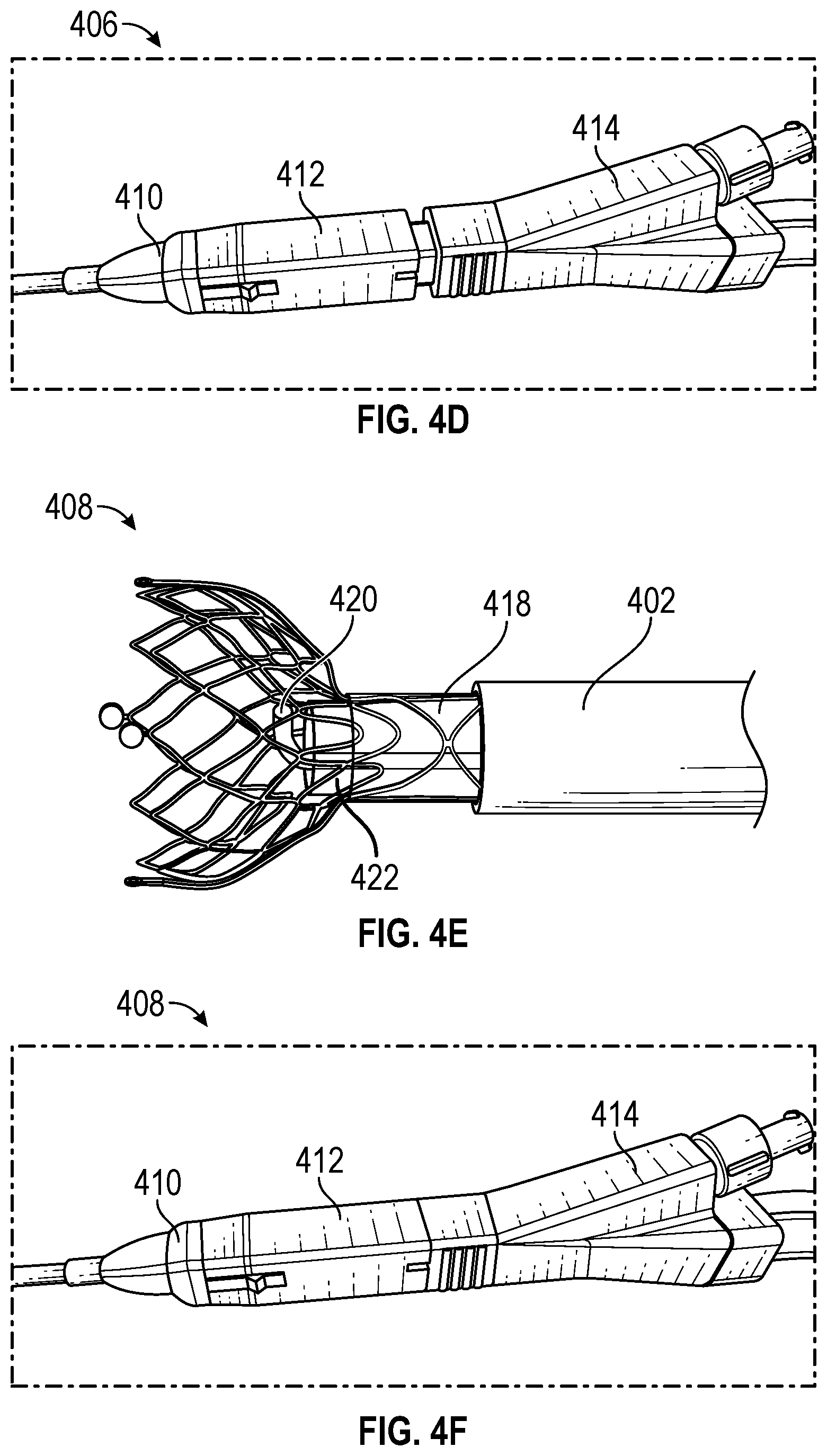 Patent US12303160 Figure 5 – Deployable dynamic stent and adjustable cutting jet device