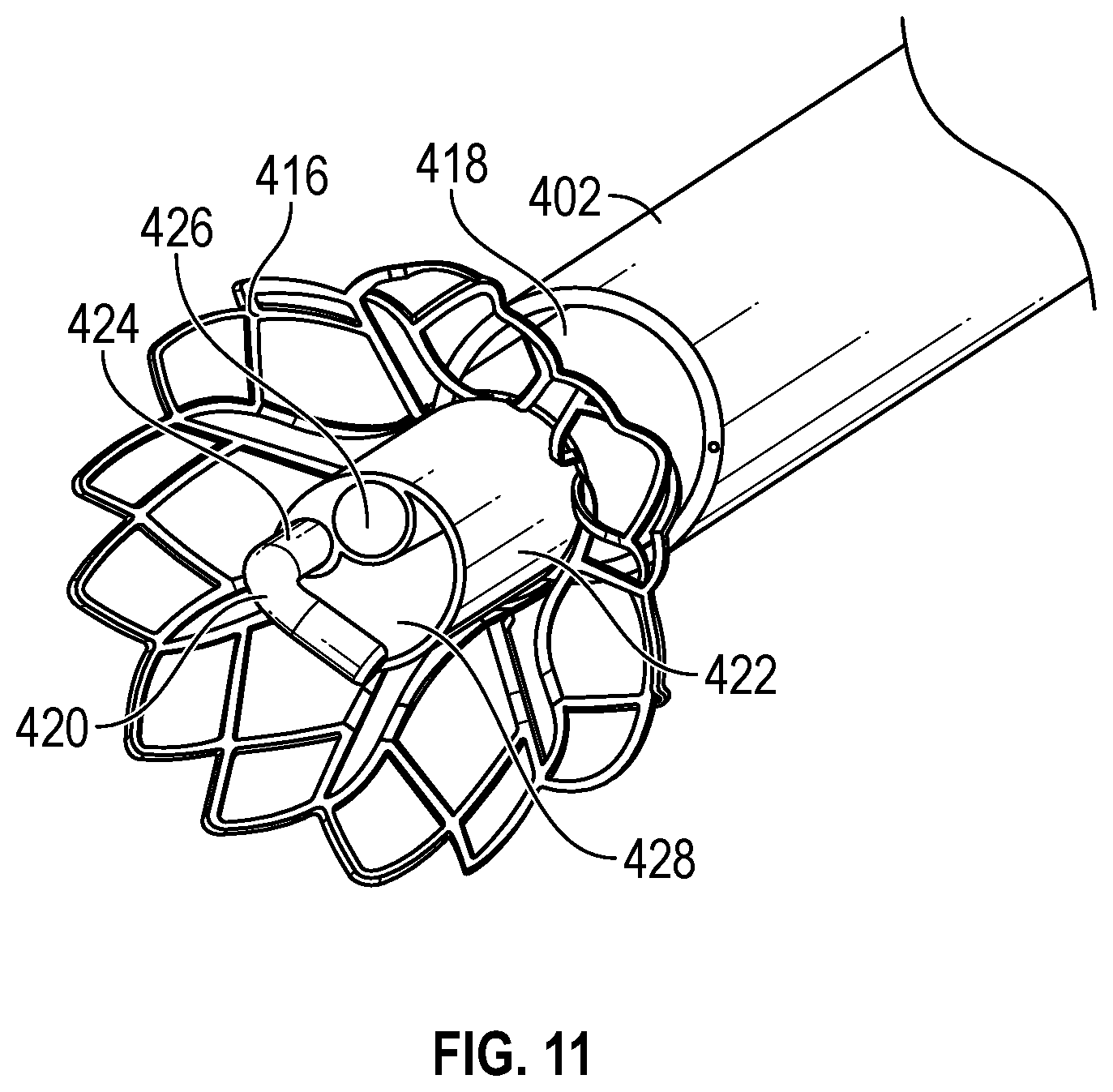 Patent US12303160 Figure 14 – Deployable dynamic stent and adjustable cutting jet device