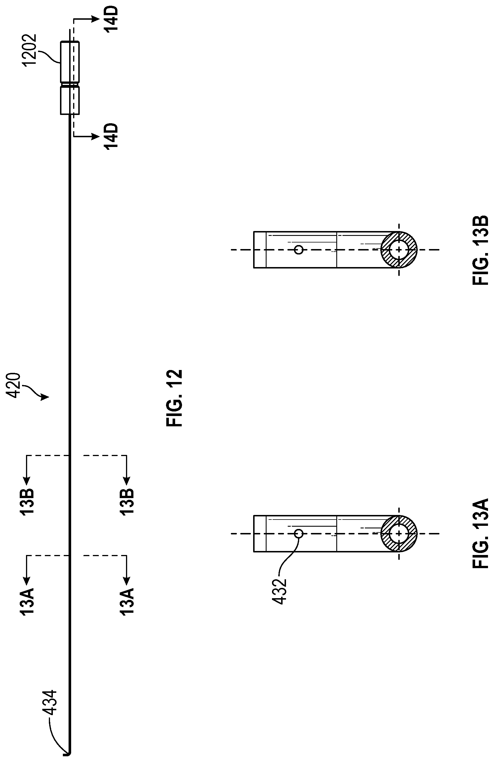 Patent US12303160 Figure 15 – Deployable dynamic stent and adjustable cutting jet device