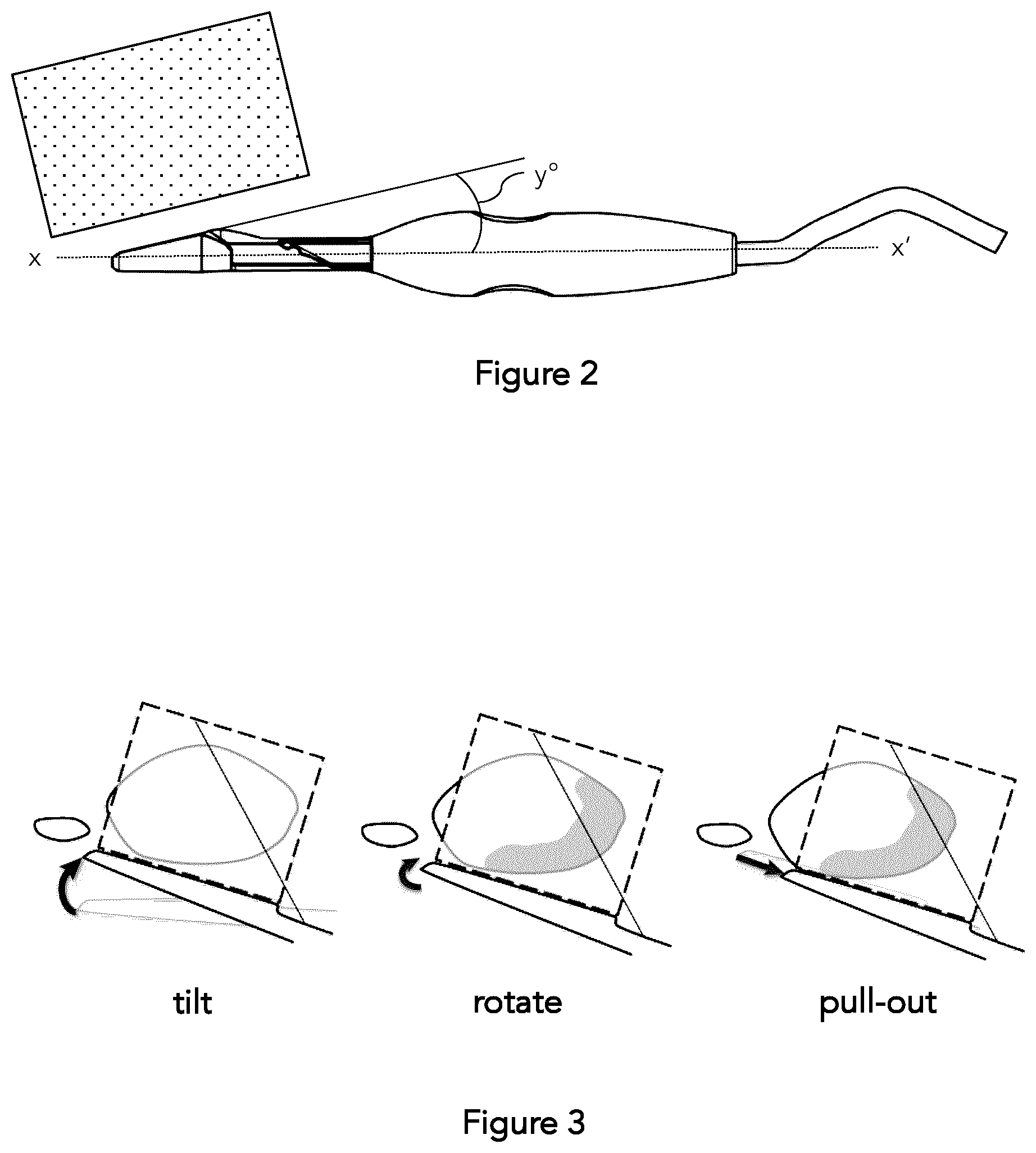 Patent US12303162 Figure 2 – Needle guide for an angled endocavity transducer