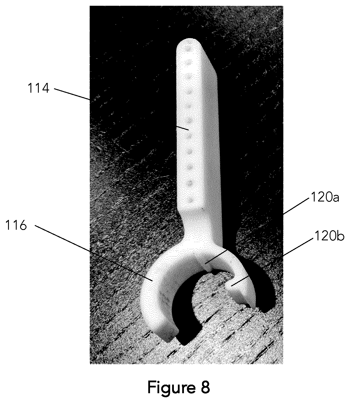 Patent US12303162 Figure 7 – Needle guide for an angled endocavity transducer