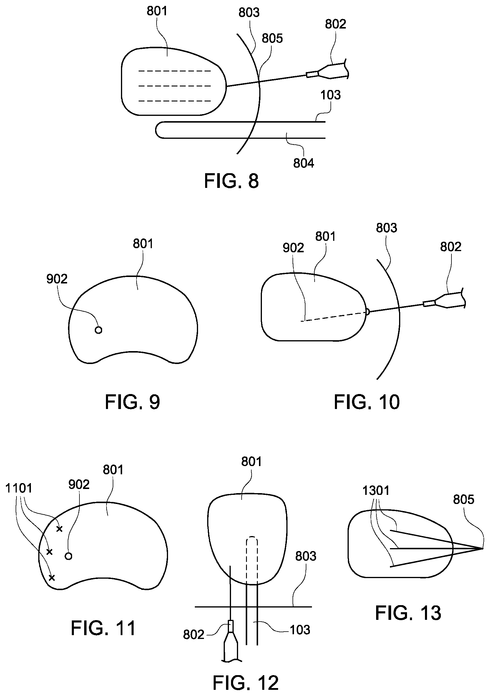 Patent US12303163 Figure 5 – Transperineal prostate biopsy device, systems, and methods of use