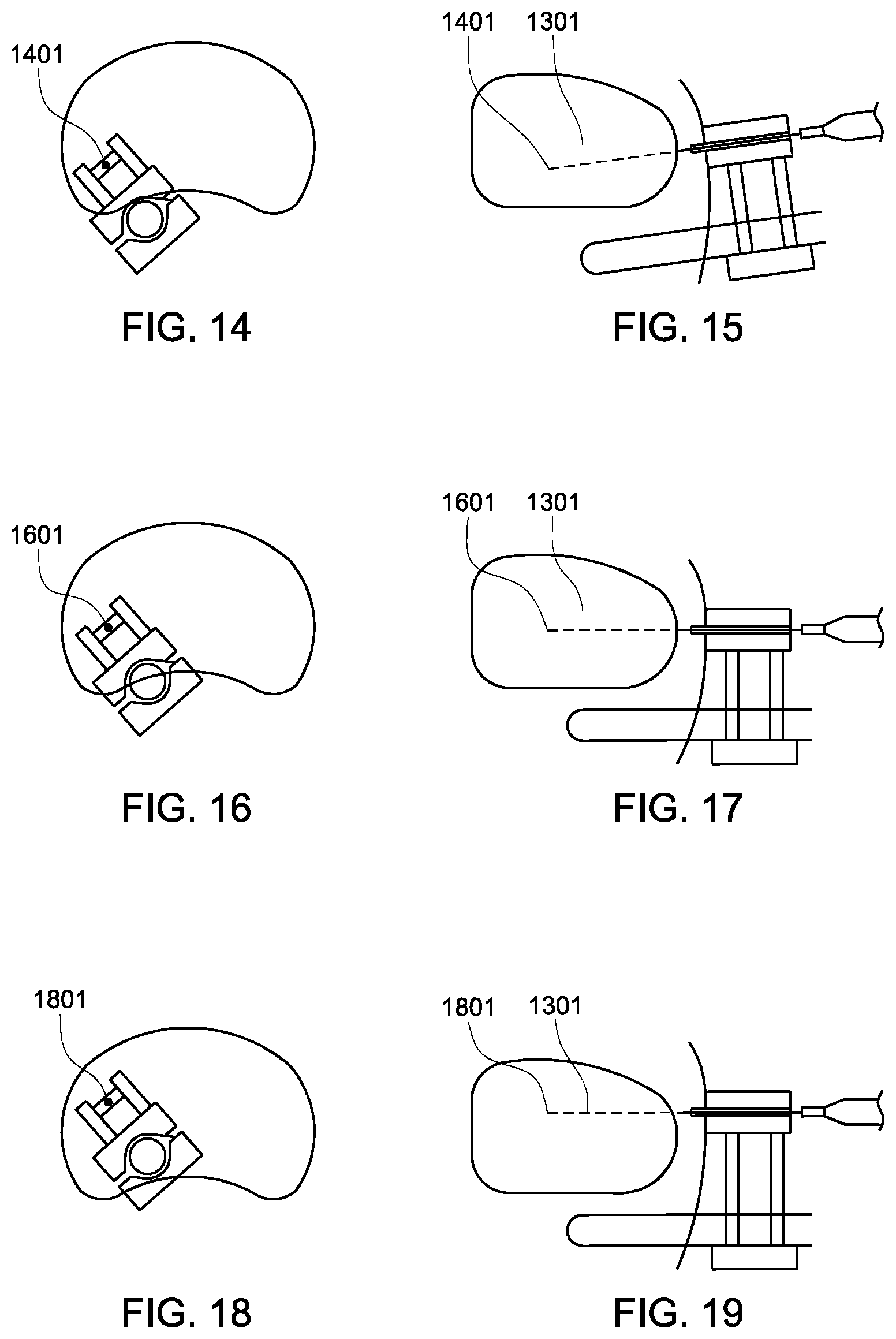 Patent US12303163 Figure 6 – Transperineal prostate biopsy device, systems, and methods of use