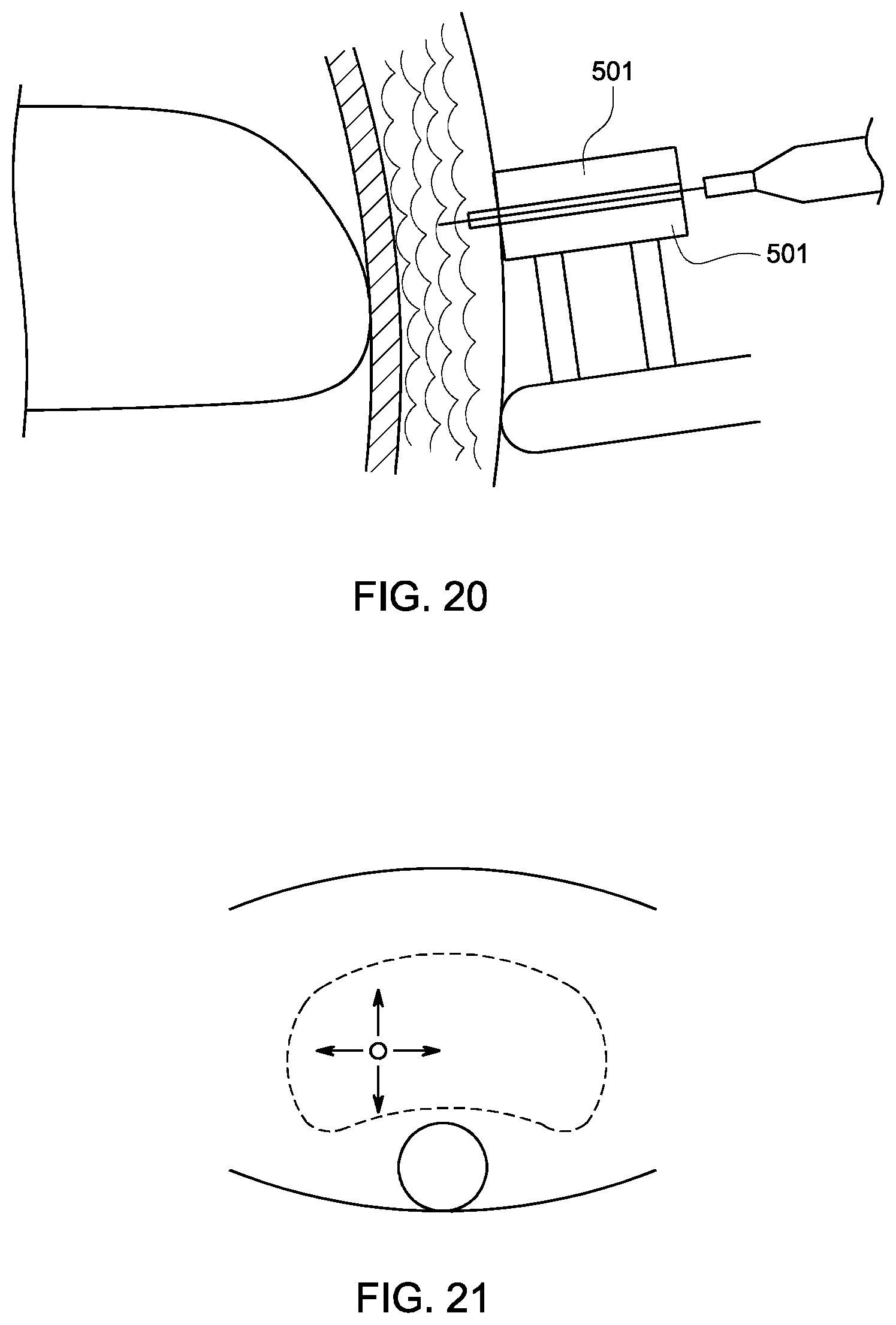 Patent US12303163 Figure 7 – Transperineal prostate biopsy device, systems, and methods of use