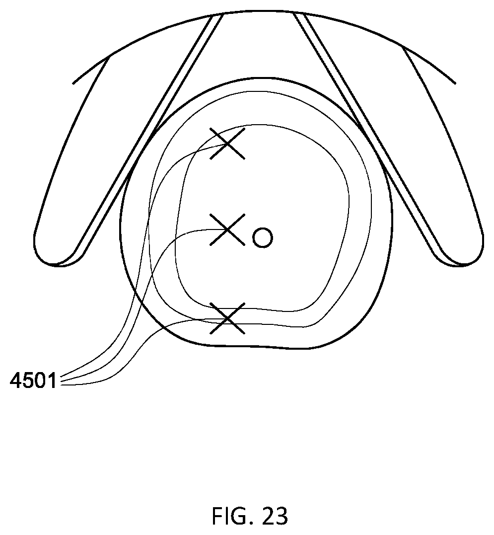 Patent US12303163 Figure 9 – Transperineal prostate biopsy device, systems, and methods of use