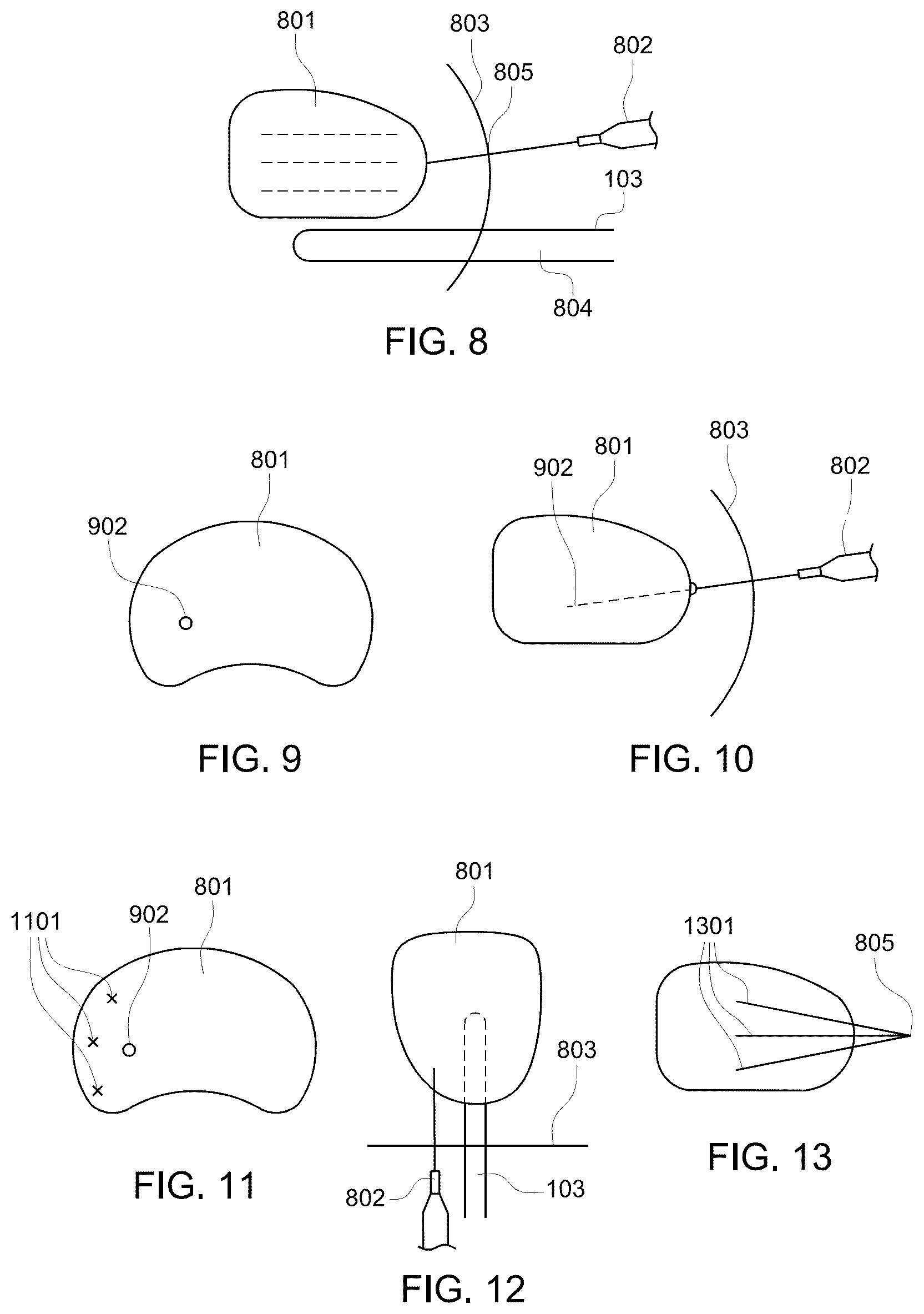 Patent US12303164 Figure 5 – Transperineal biopsy guide with mount, guide member, and displacement member displaceable within a gap of the guide member