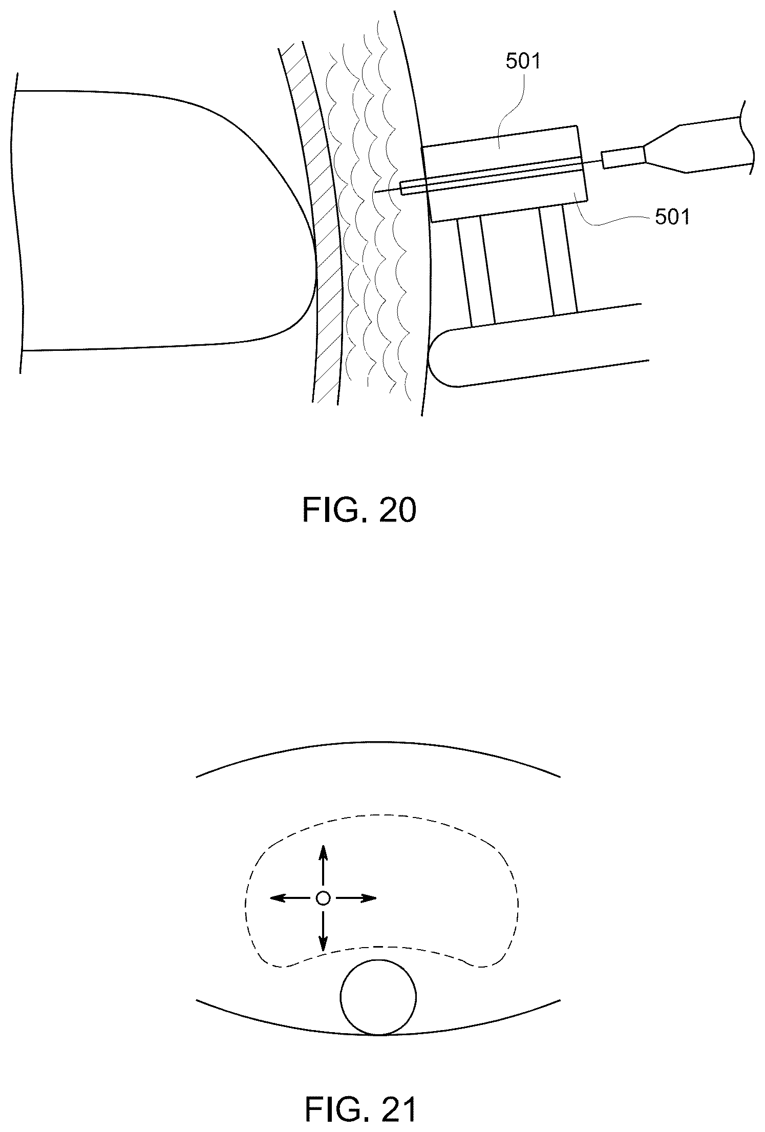 Patent US12303164 Figure 7 – Transperineal biopsy guide with mount, guide member, and displacement member displaceable within a gap of the guide member