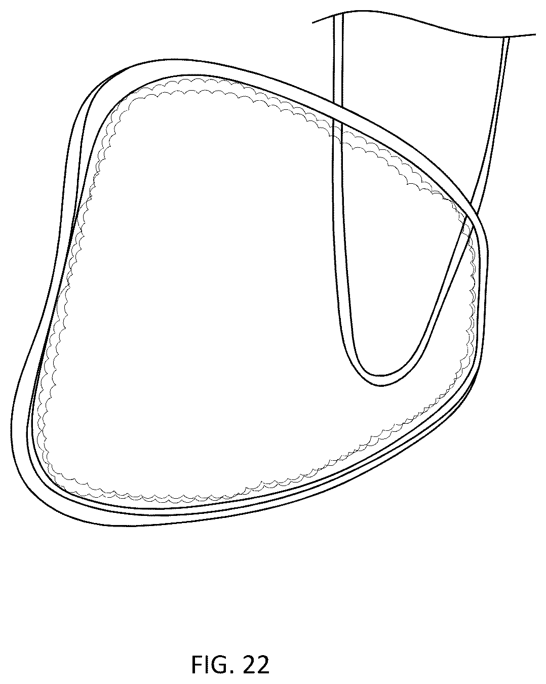 Patent US12303164 Figure 8 – Transperineal biopsy guide with mount, guide member, and displacement member displaceable within a gap of the guide member