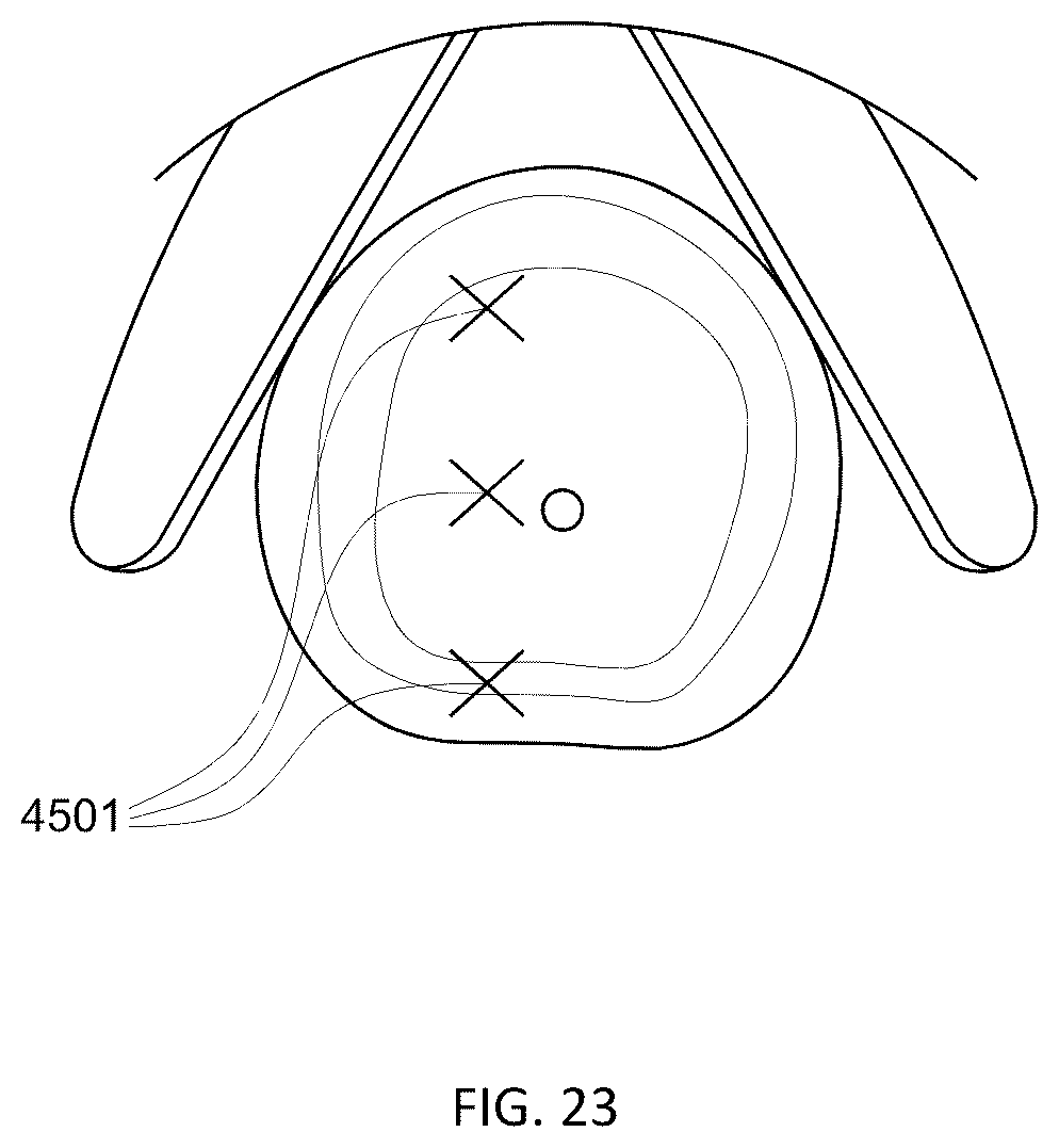Patent US12303164 Figure 9 – Transperineal biopsy guide with mount, guide member, and displacement member displaceable within a gap of the guide member