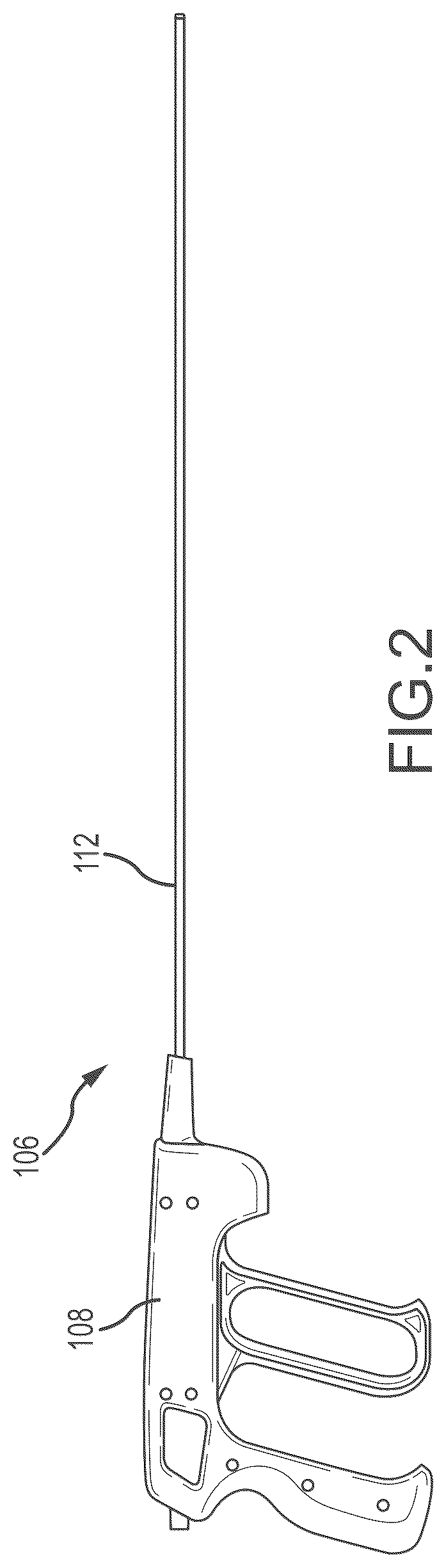 Patent US12303165 Figure 2 – Medical device for removing an implanted object using laser cut hypotubes