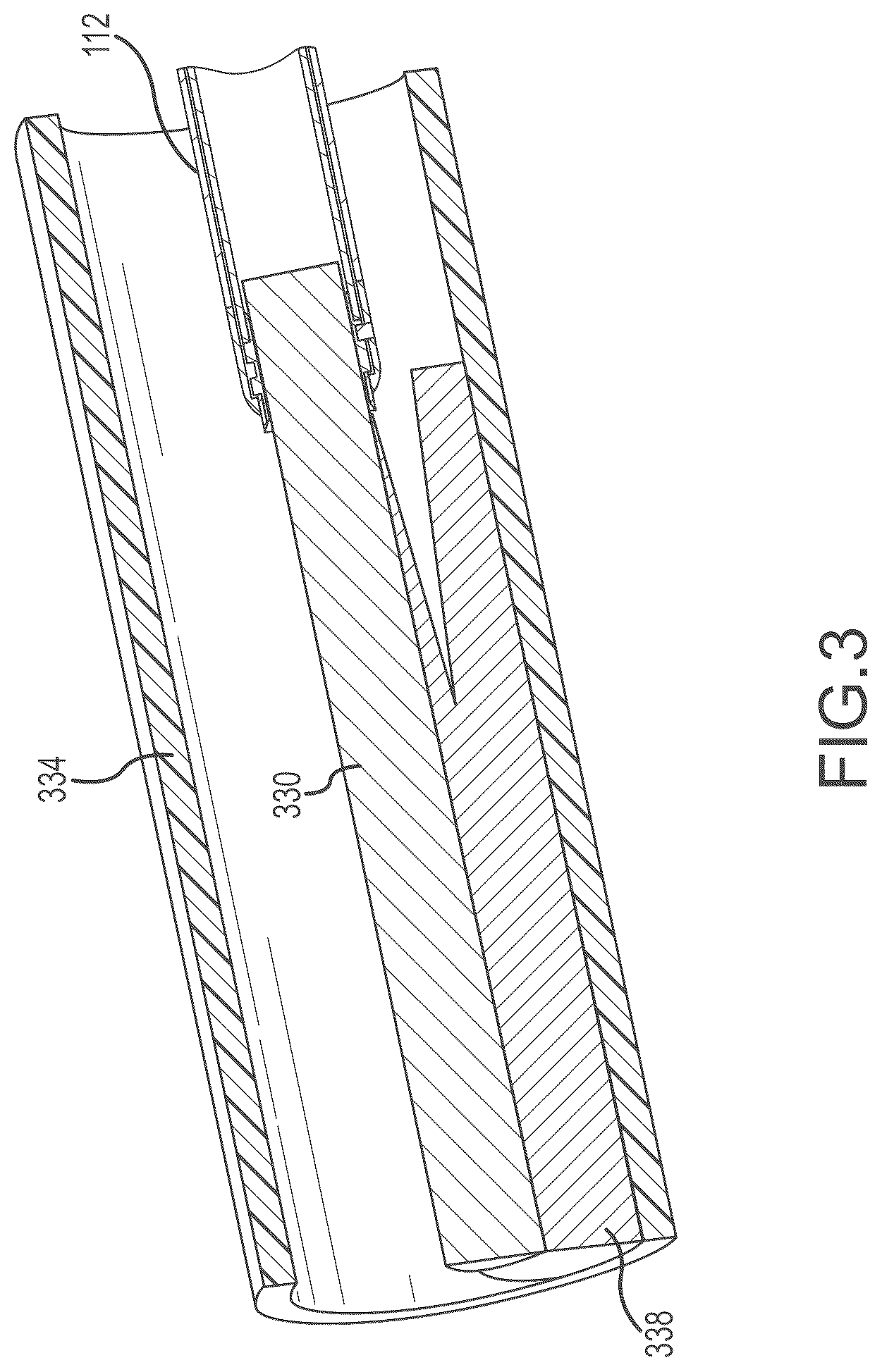 Patent US12303165 Figure 3 – Medical device for removing an implanted object using laser cut hypotubes