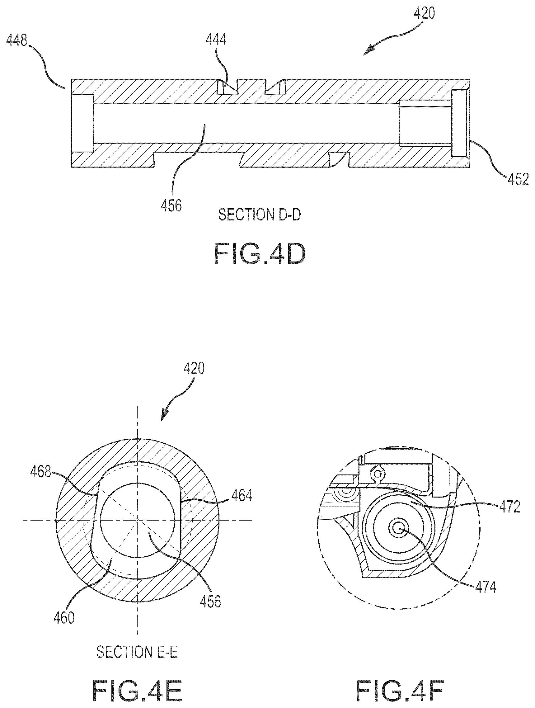 Patent US12303165 Figure 6 – Medical device for removing an implanted object using laser cut hypotubes