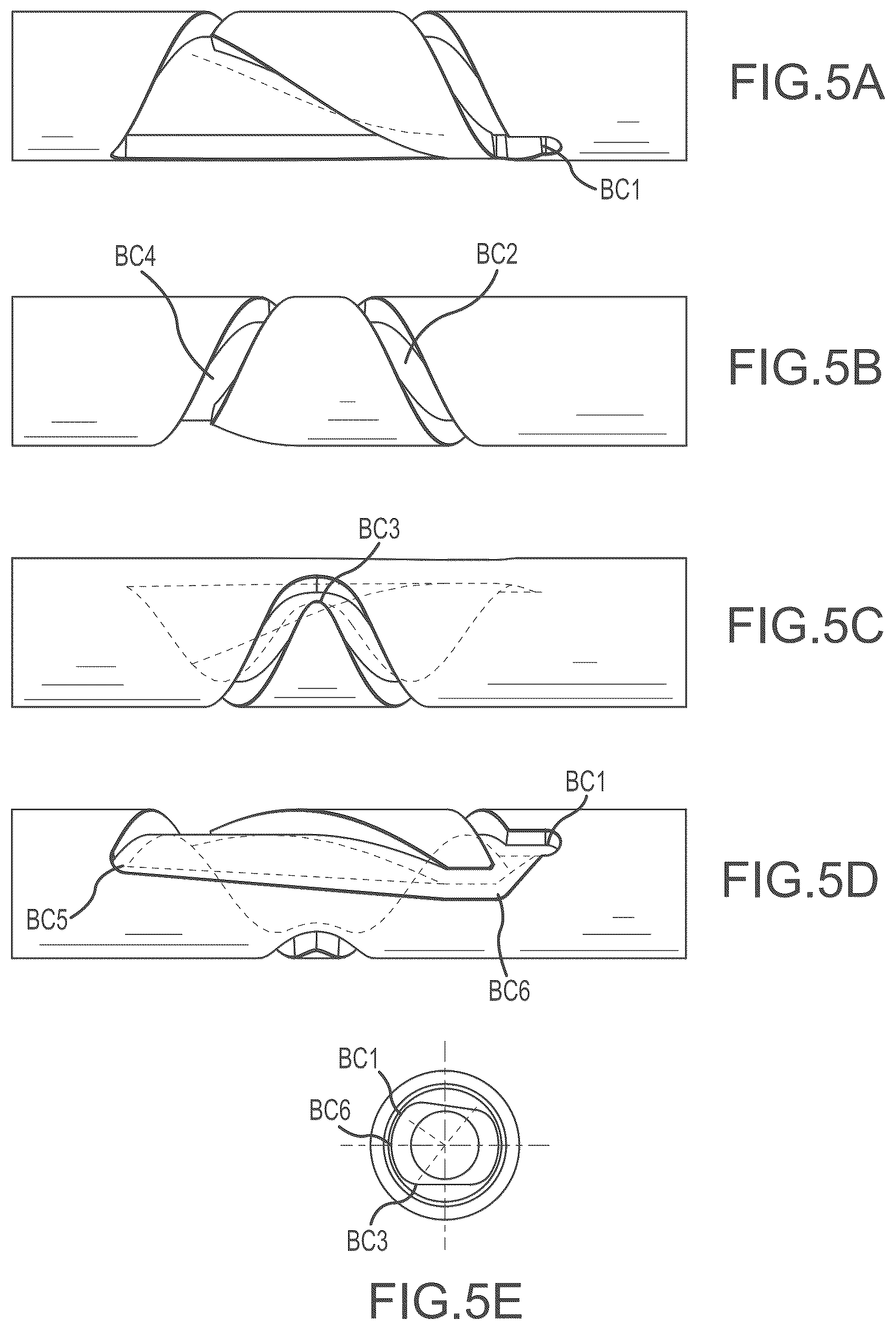 Patent US12303165 Figure 7 – Medical device for removing an implanted object using laser cut hypotubes