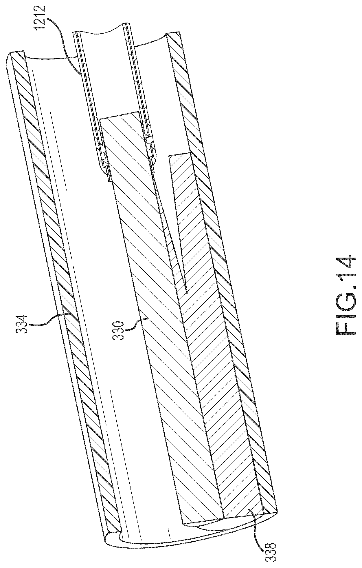 Patent US12303165 Figure 16 – Medical device for removing an implanted object using laser cut hypotubes