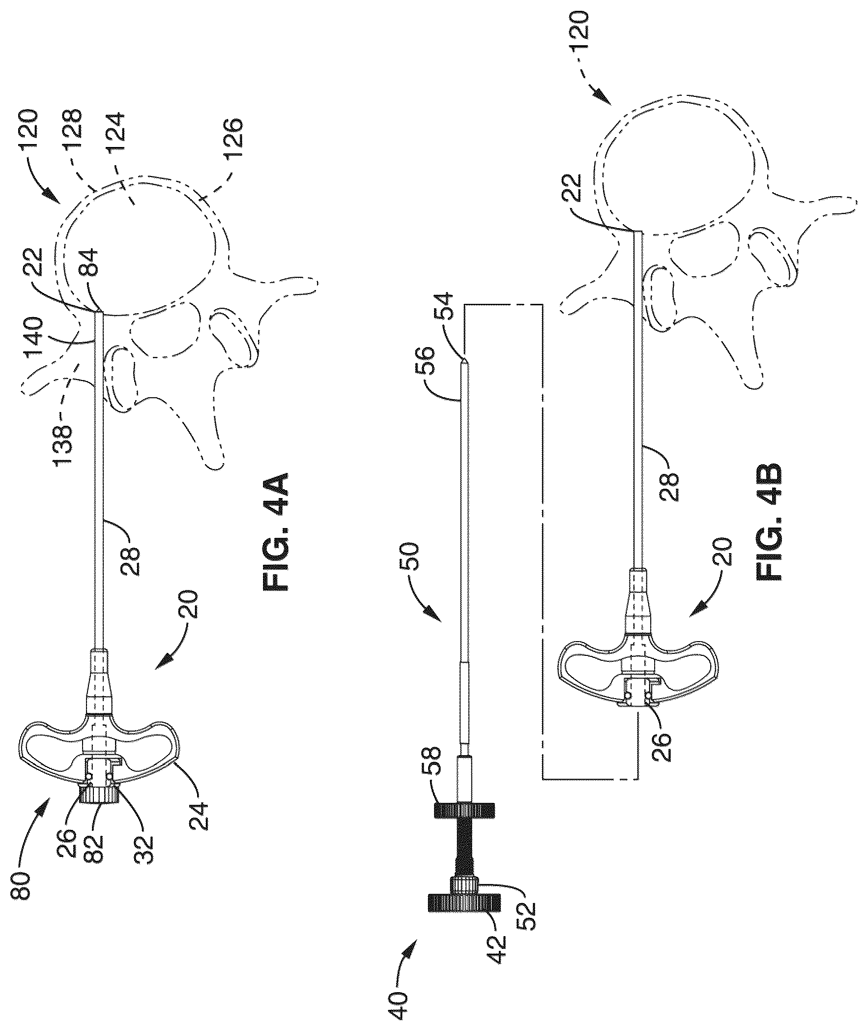 Patent US12303166 Figure 4 – Methods for accessing nerves within bone