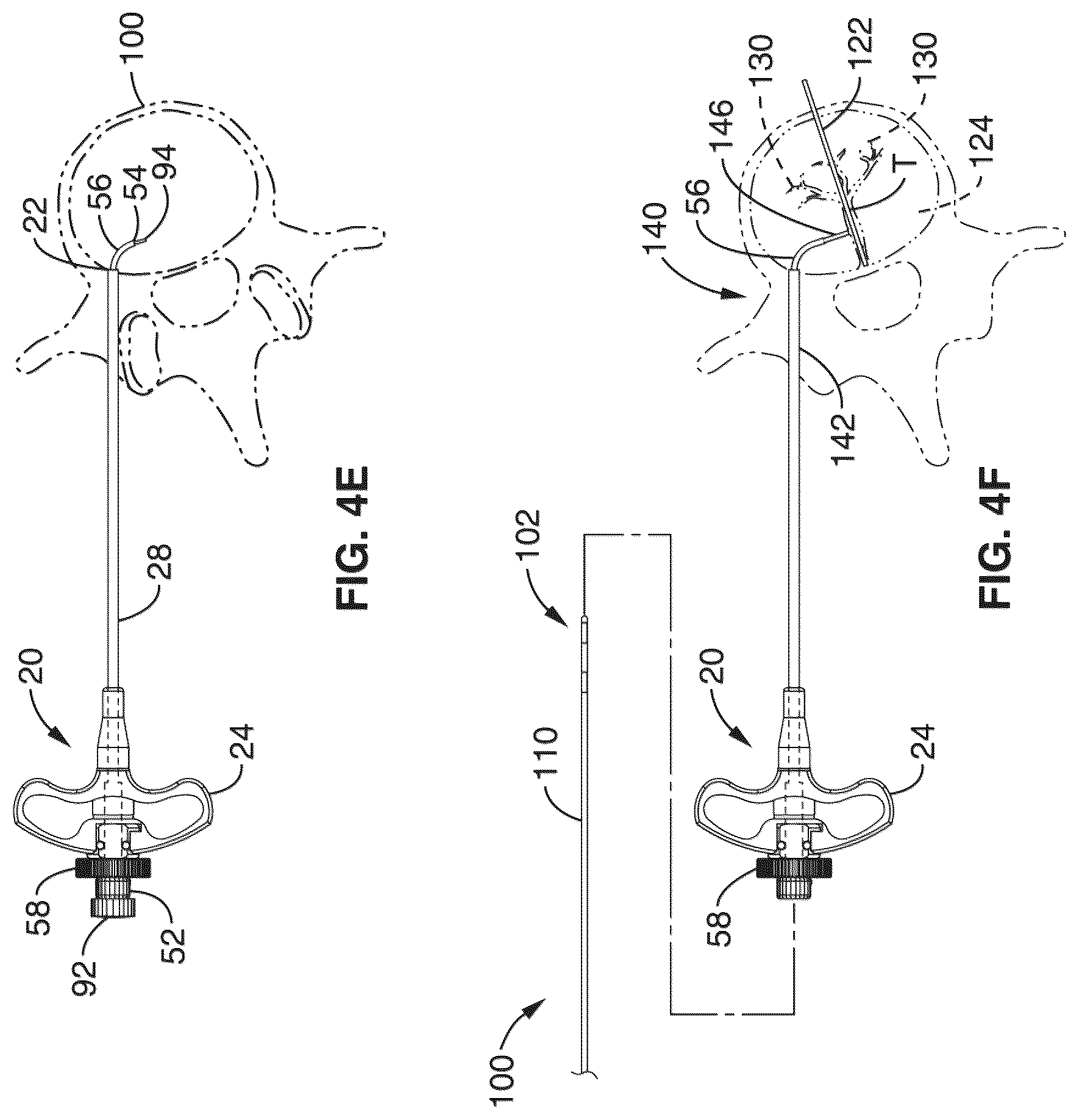 Patent US12303166 Figure 6 – Methods for accessing nerves within bone